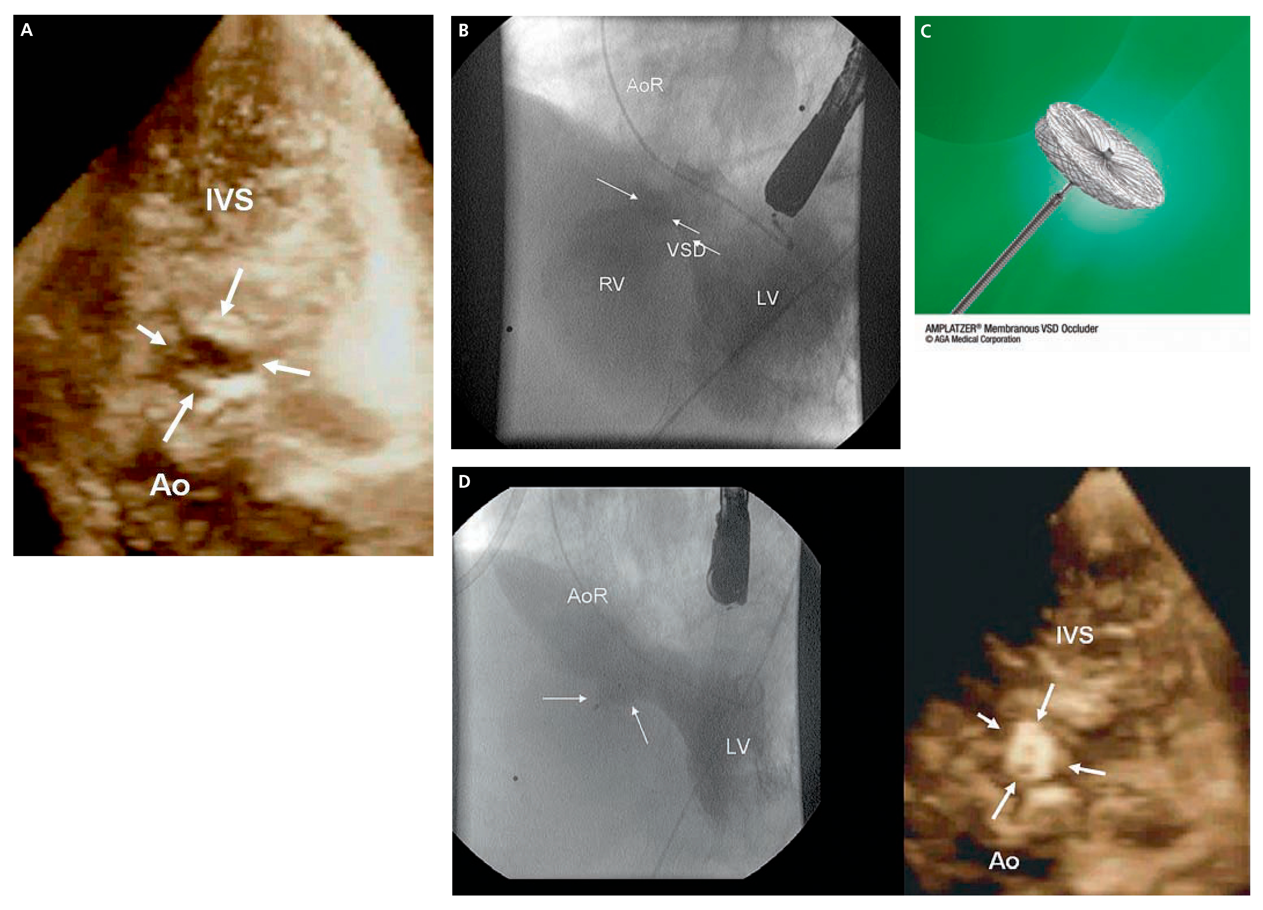Cardiovascmed 11 00016 g001 Cardiovascmed 11 00016 g001