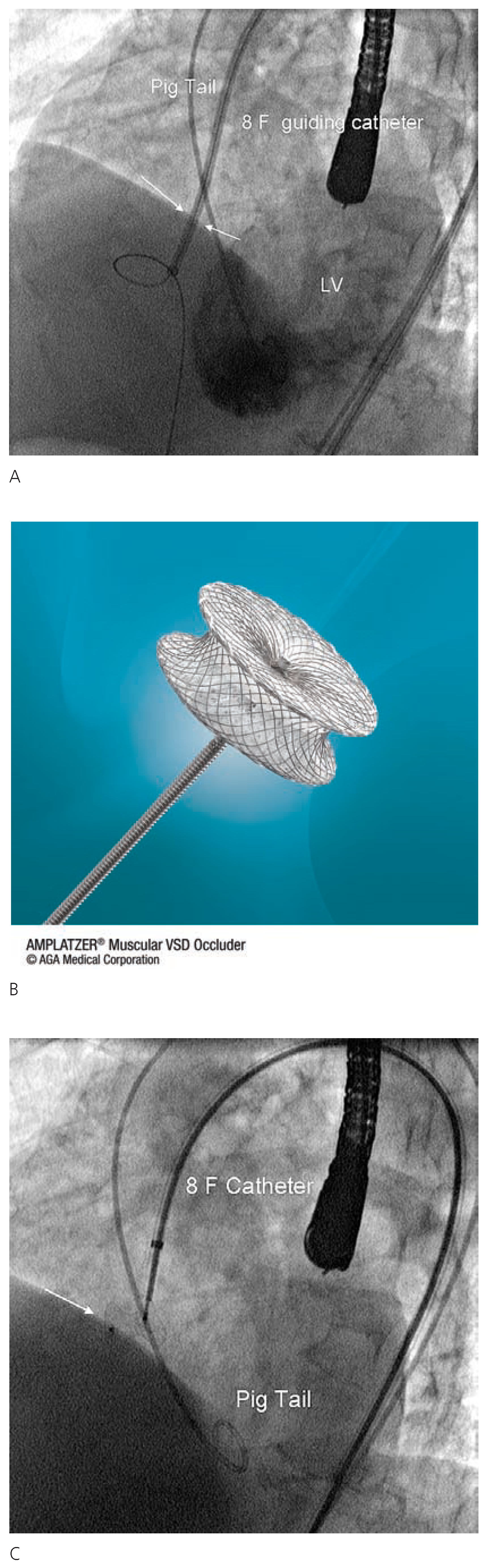 Cardiovascmed 11 00016 g002 Cardiovascmed 11 00016 g002