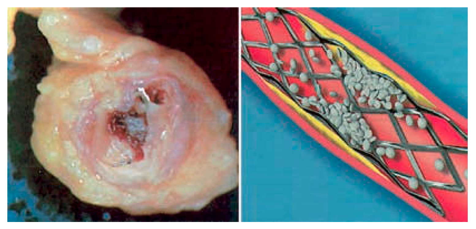 Cardiovascmed 11 00022 g001