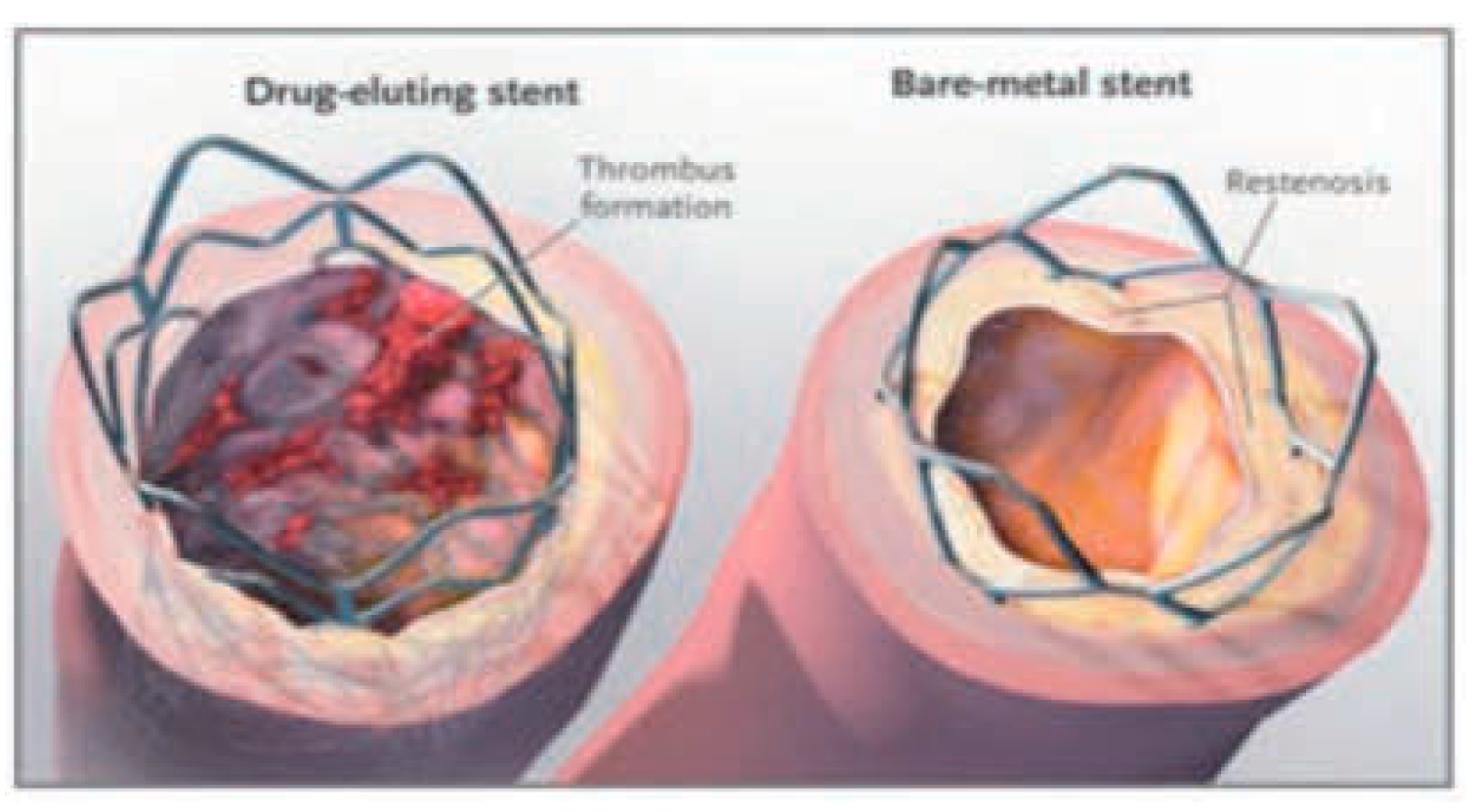 Cardiovascmed 11 00022 g002
