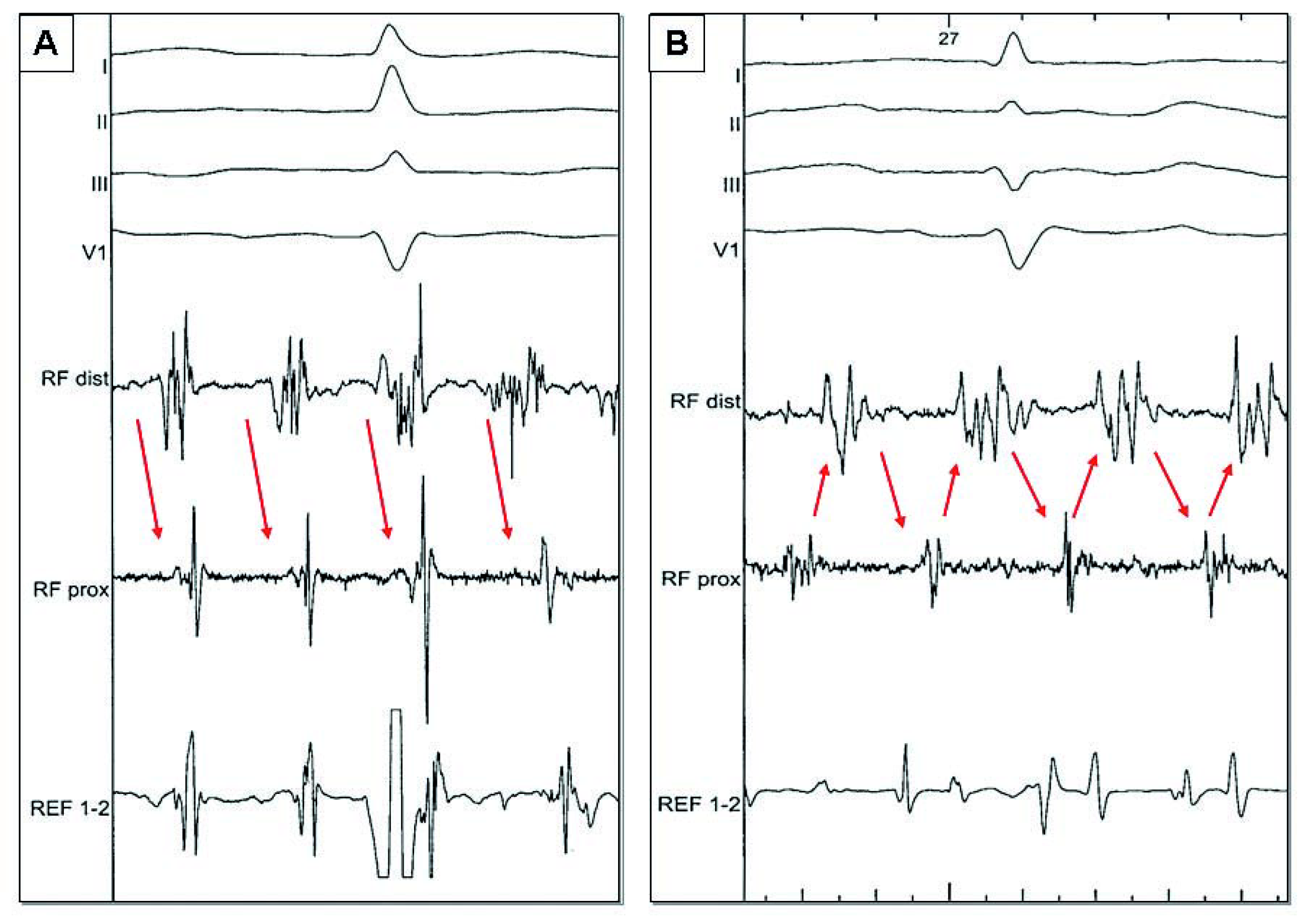 Cardiovascmed 11 00039 g002 Cardiovascmed 11 00039 g002