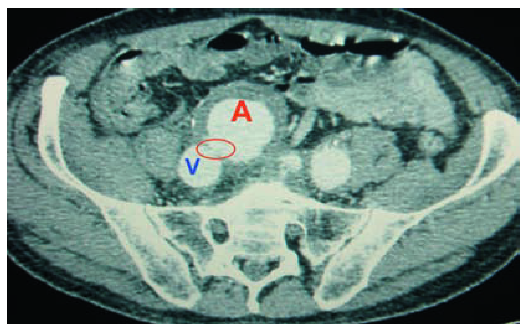 Cardiovascmed 11 00061 i001
