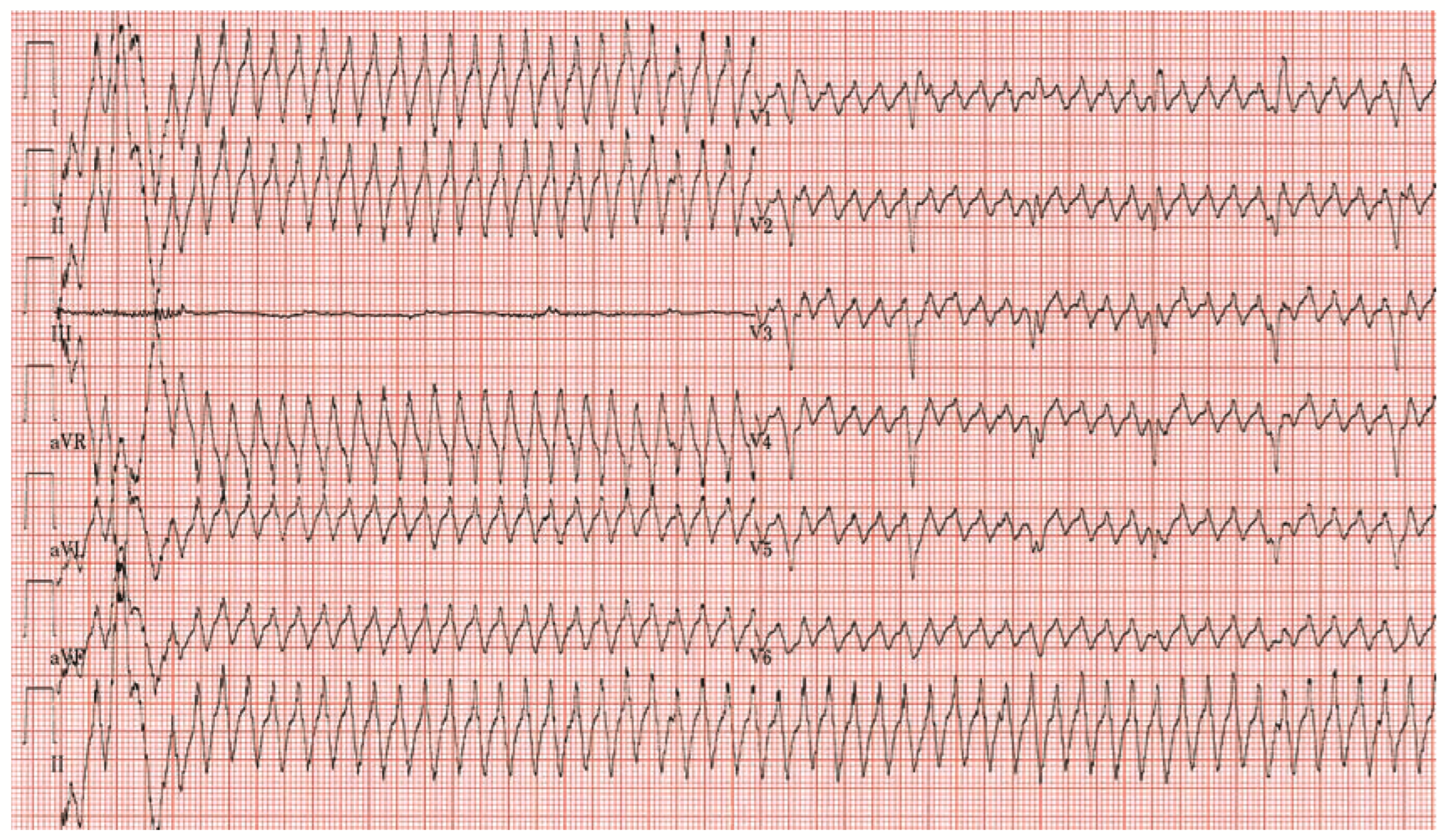 Cardiovascmed 11 00064 g001