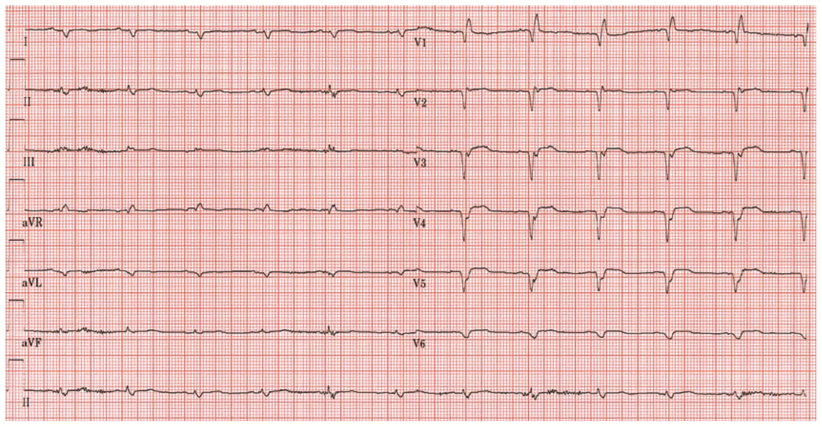 Cardiovascmed 11 00064 g002