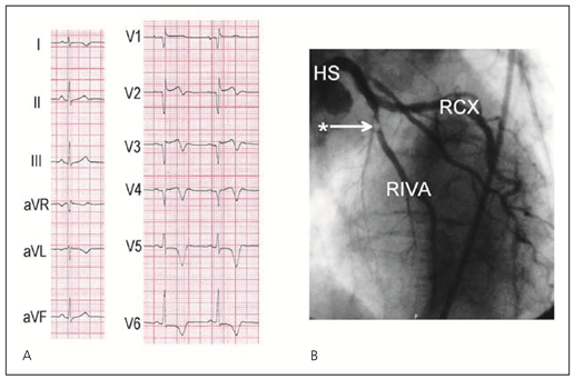Cardiovascmed 11 00083 i003 Cardiovascmed 11 00083 i003