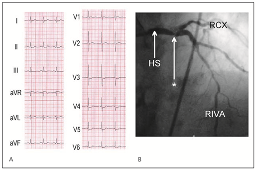 Cardiovascmed 11 00083 i004 Cardiovascmed 11 00083 i004