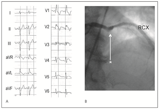Cardiovascmed 11 00083 i005 Cardiovascmed 11 00083 i005