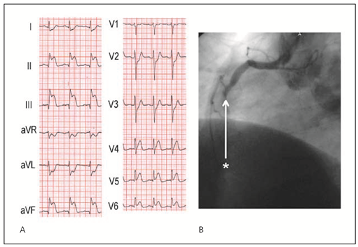 Cardiovascmed 11 00083 i007 Cardiovascmed 11 00083 i007