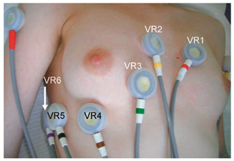 Cardiovascmed 11 00083 i008 Cardiovascmed 11 00083 i008
