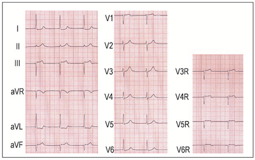 Cardiovascmed 11 00083 i009 Cardiovascmed 11 00083 i009
