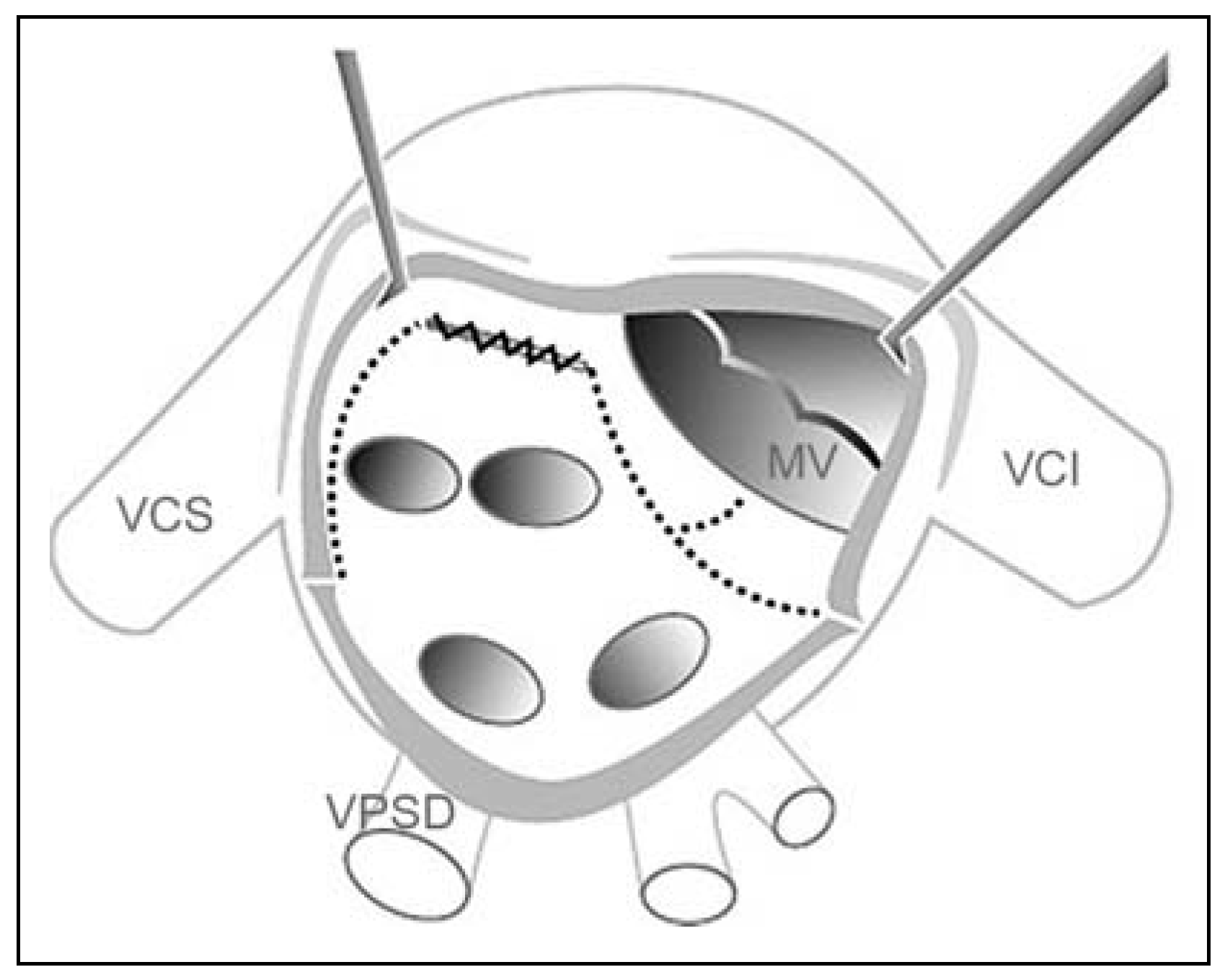 Cardiovascmed 11 00090 g002 Cardiovascmed 11 00090 g002