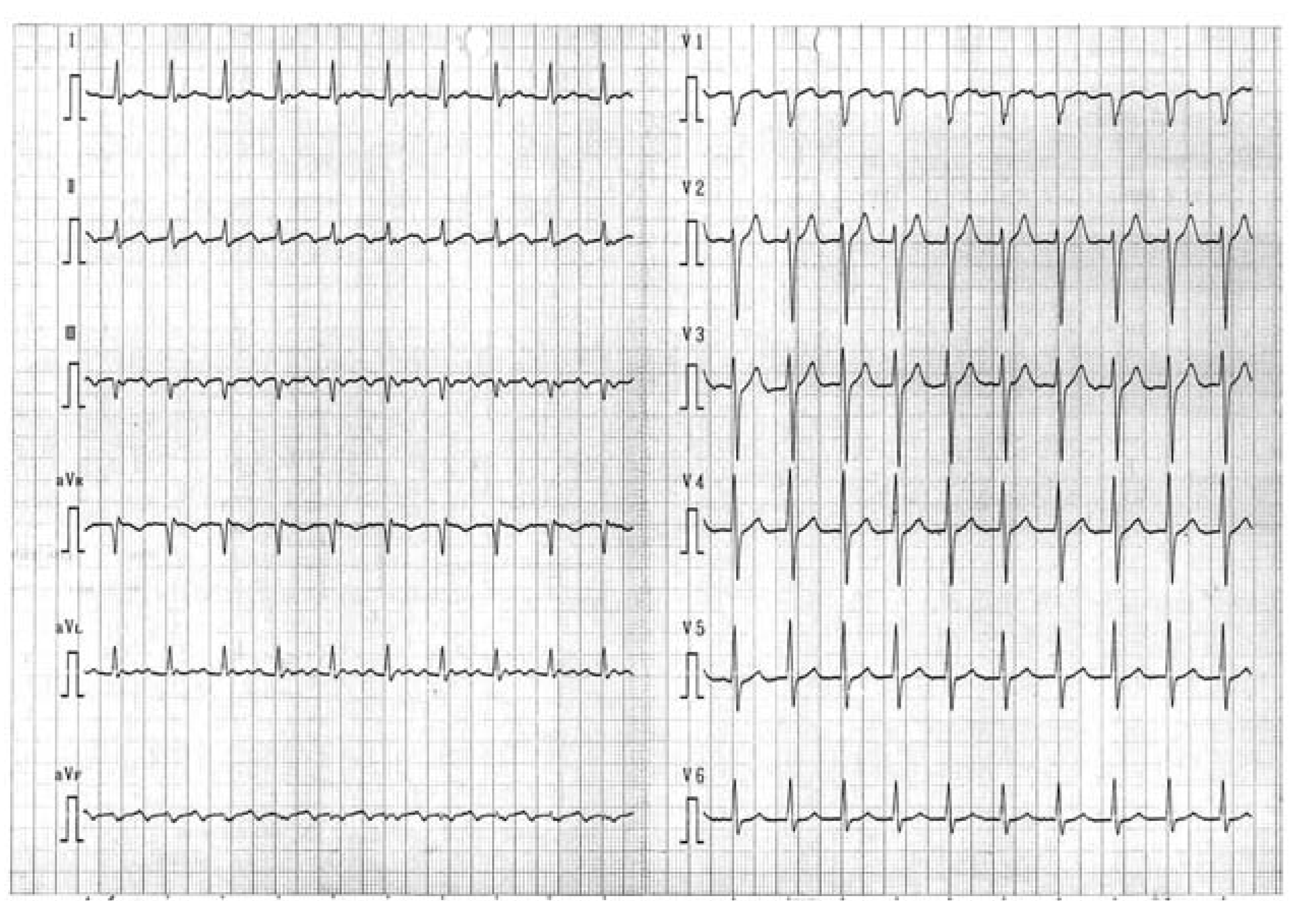 Cardiovascmed 11 00095 g001 Cardiovascmed 11 00095 g001