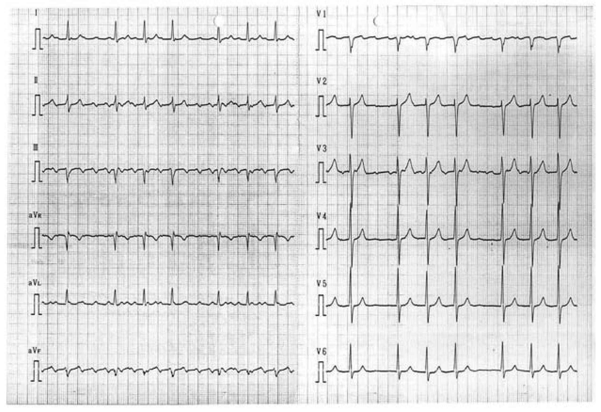 Cardiovascmed 11 00095 g002 Cardiovascmed 11 00095 g002