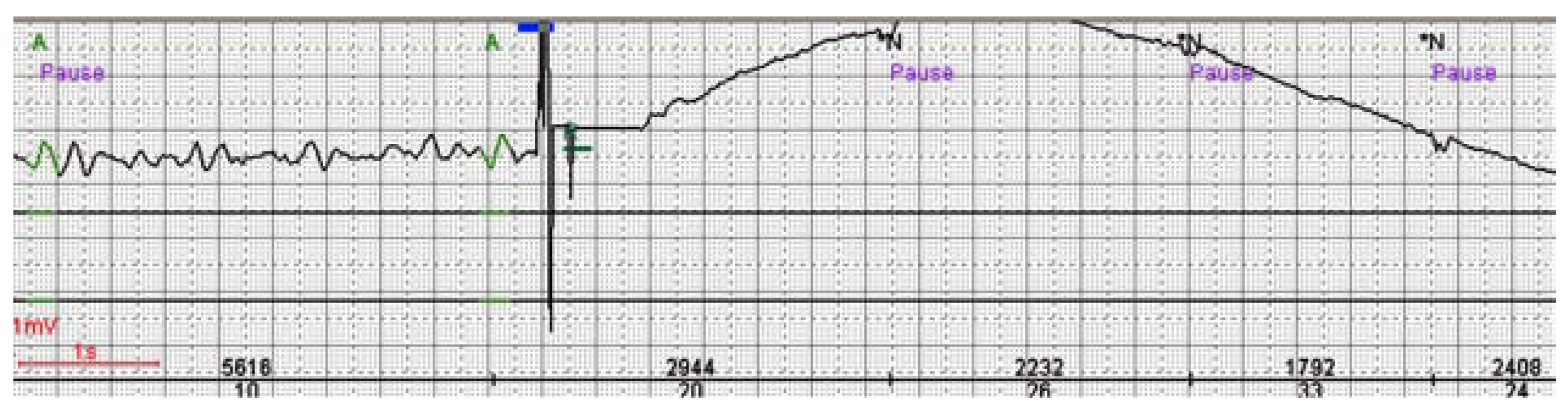 Cardiovascmed 11 00097 g004 Cardiovascmed 11 00097 g004