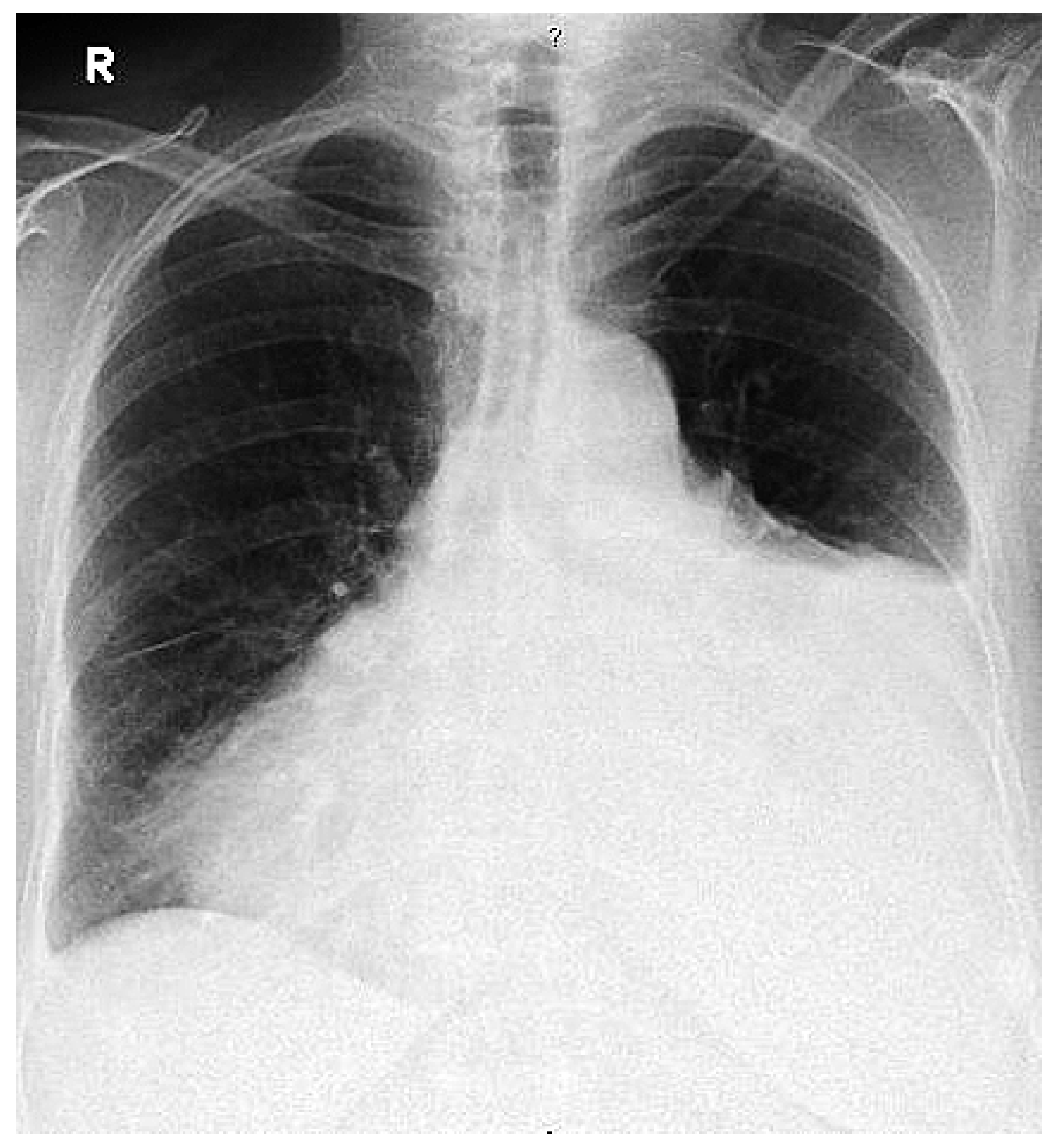 Cardiovascmed 11 00157 g001