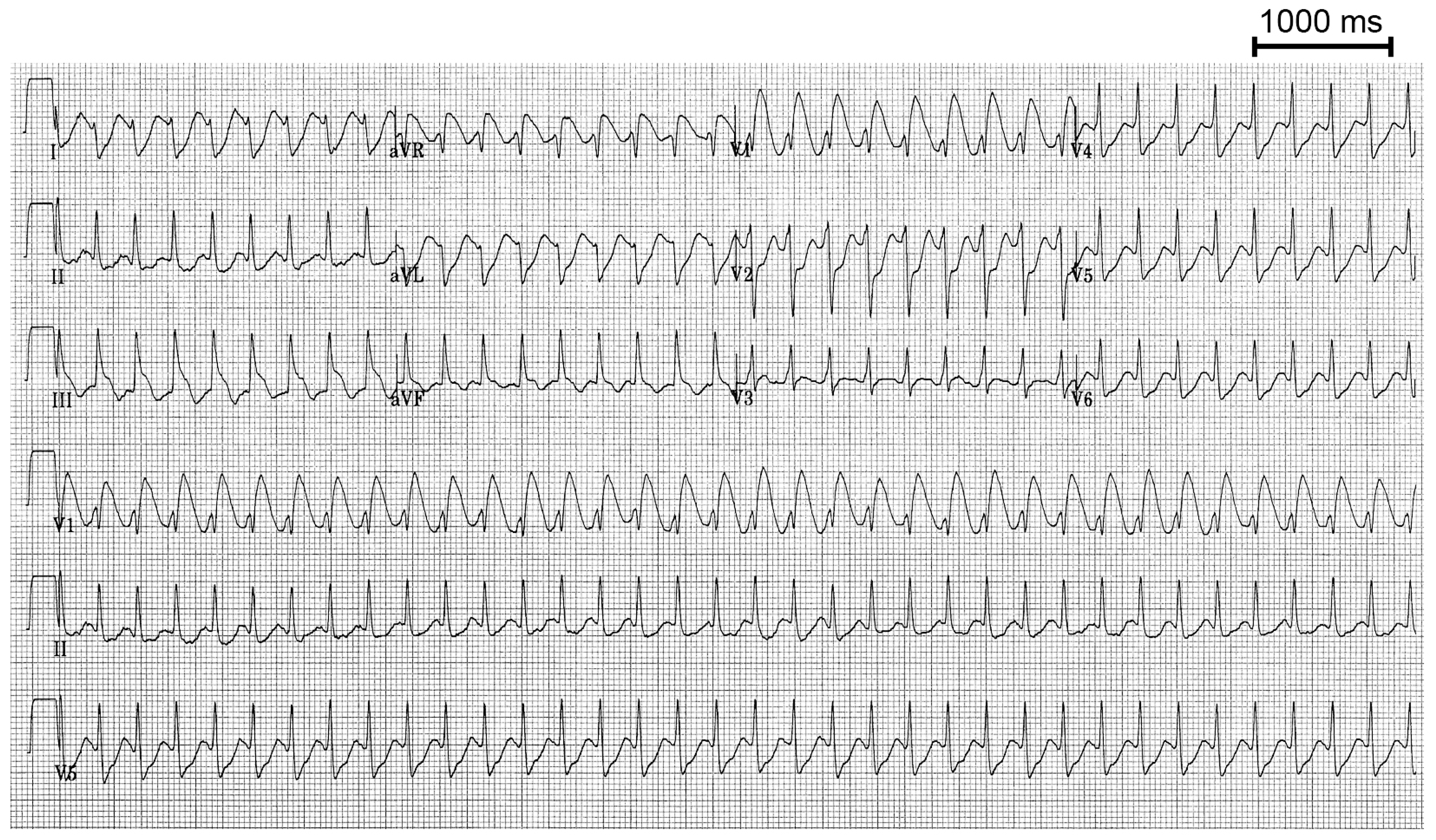 Cardiovascmed 11 00166 g001 Cardiovascmed 11 00166 g001
