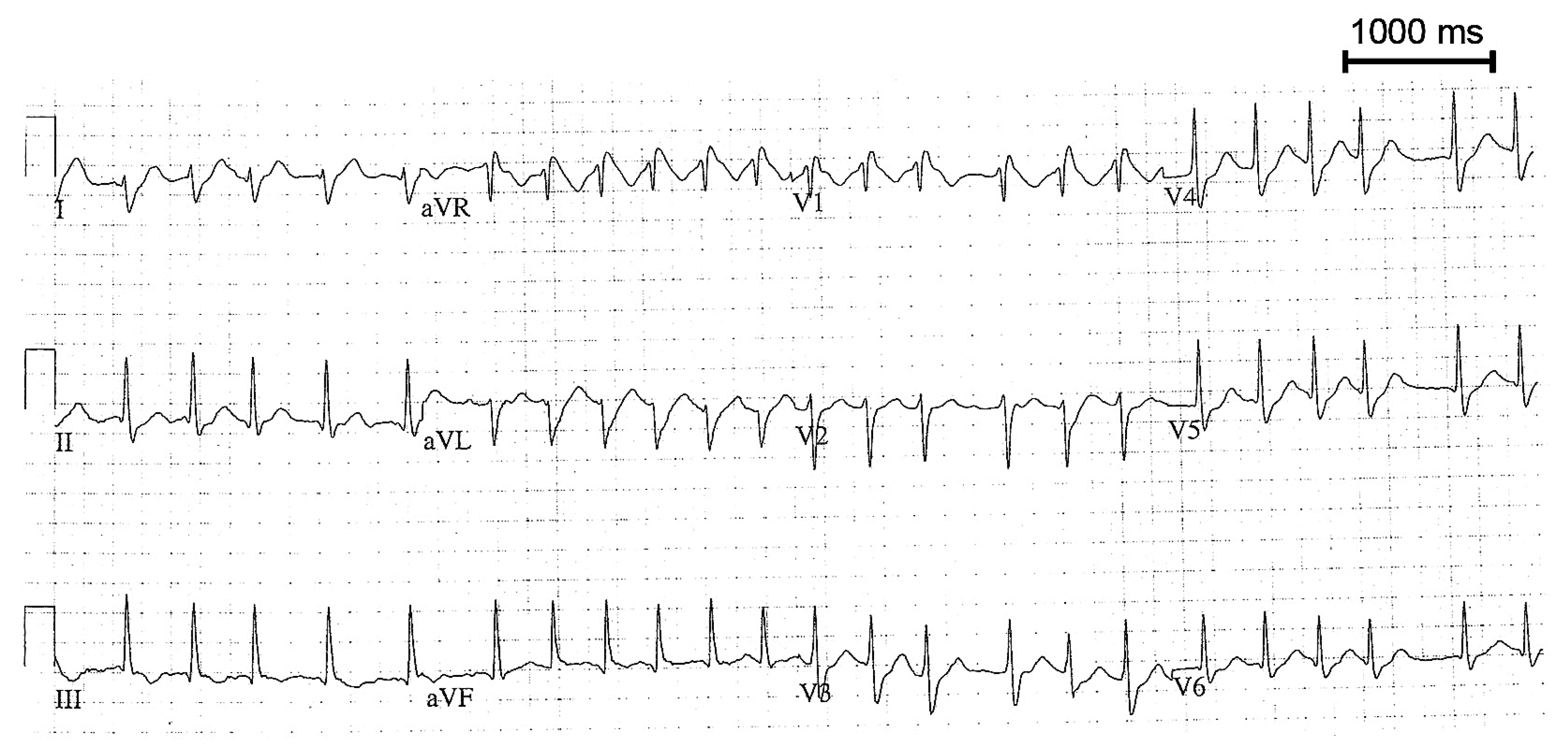 Cardiovascmed 11 00166 g002 Cardiovascmed 11 00166 g002