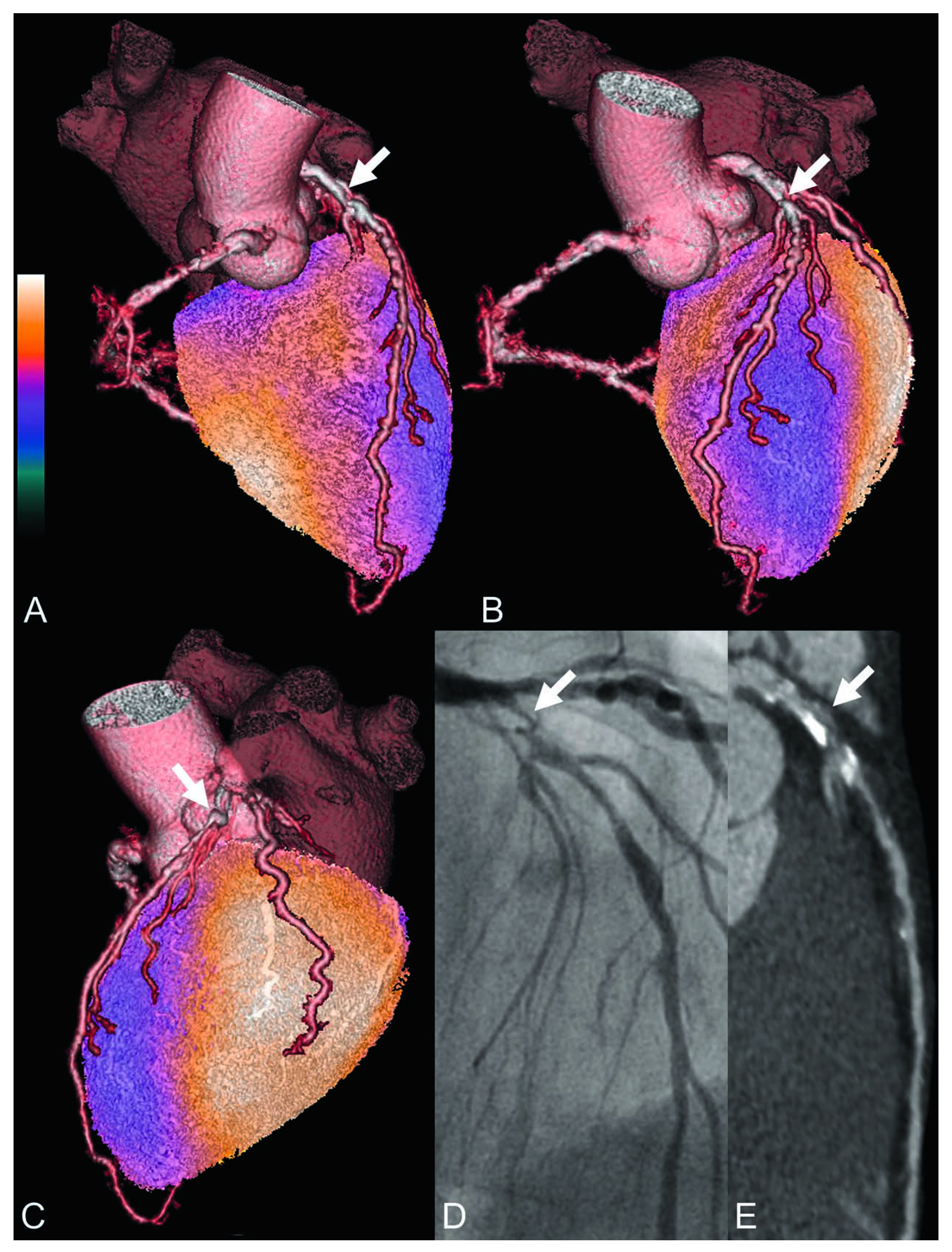 Cardiovascmed 11 00168 g001