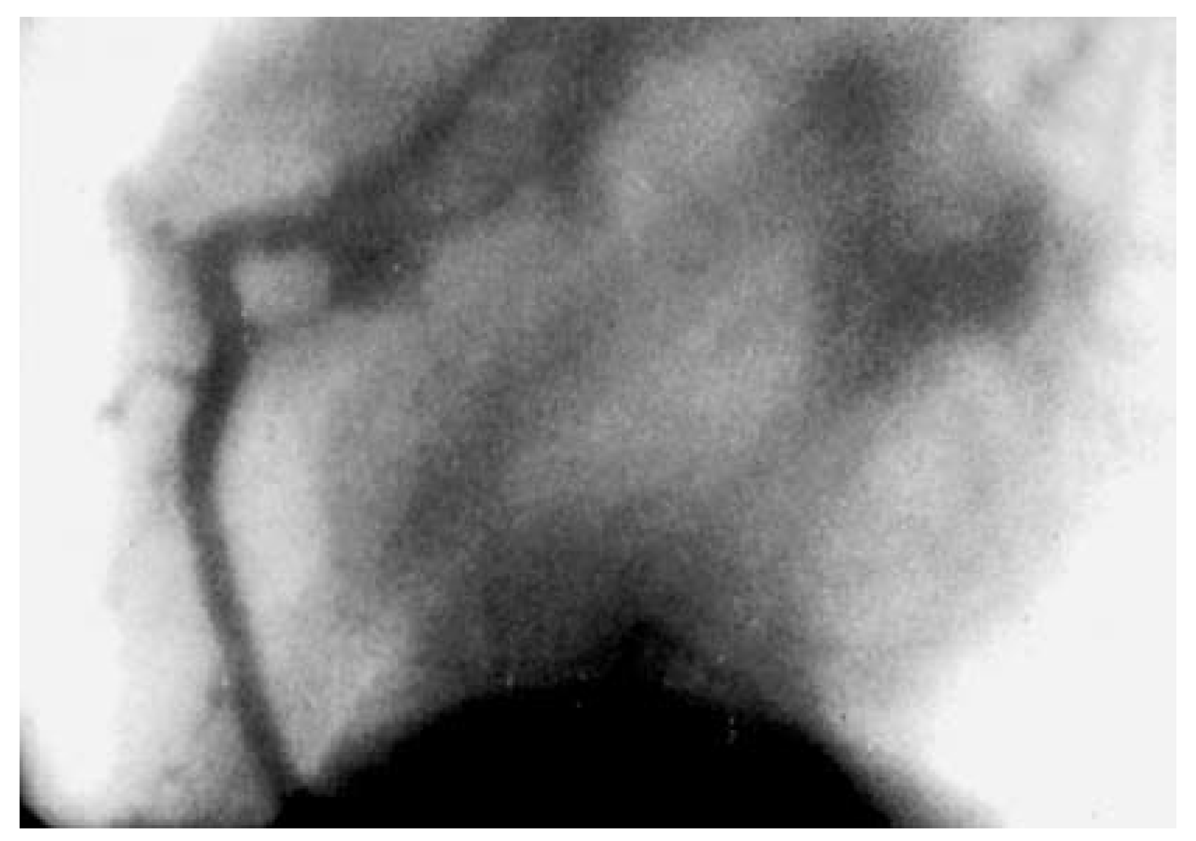 Cardiovascmed 11 00196 g001