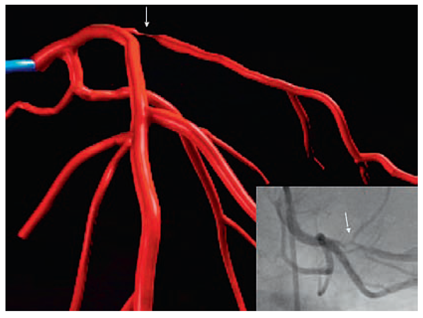 Cardiovascmed 11 00196 g002