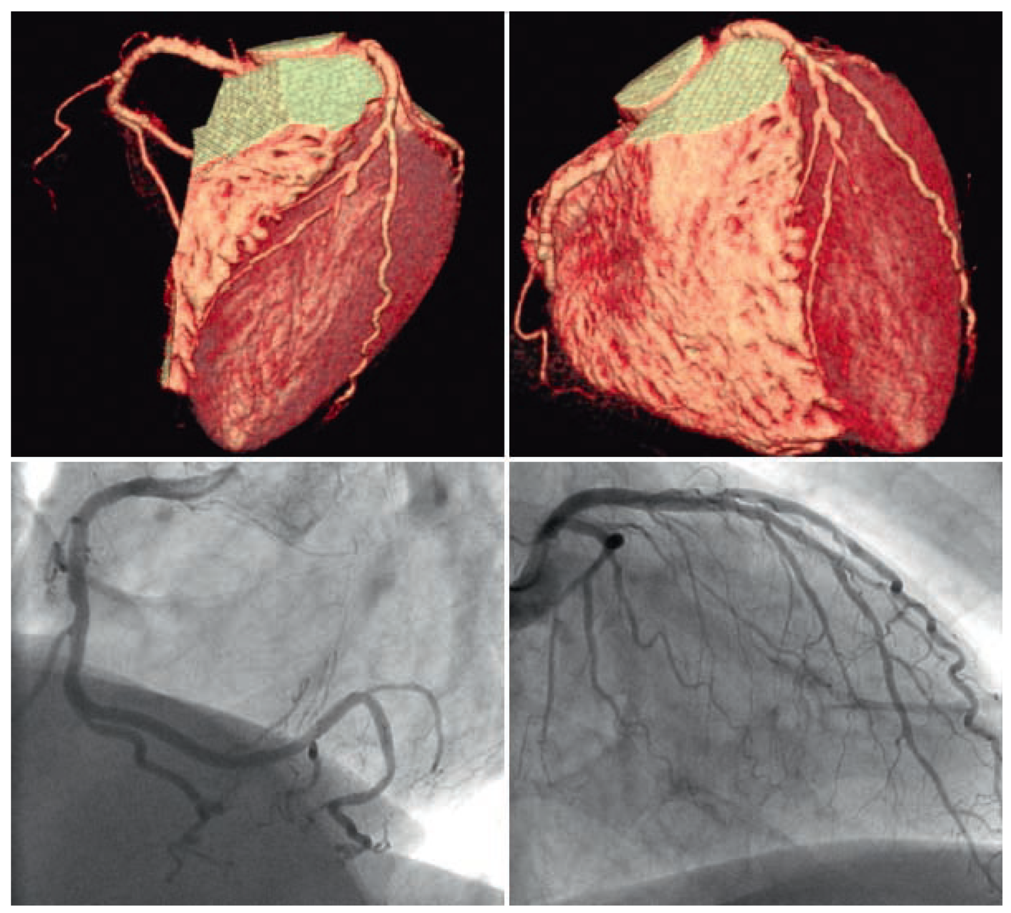 Cardiovascmed 11 00196 g003