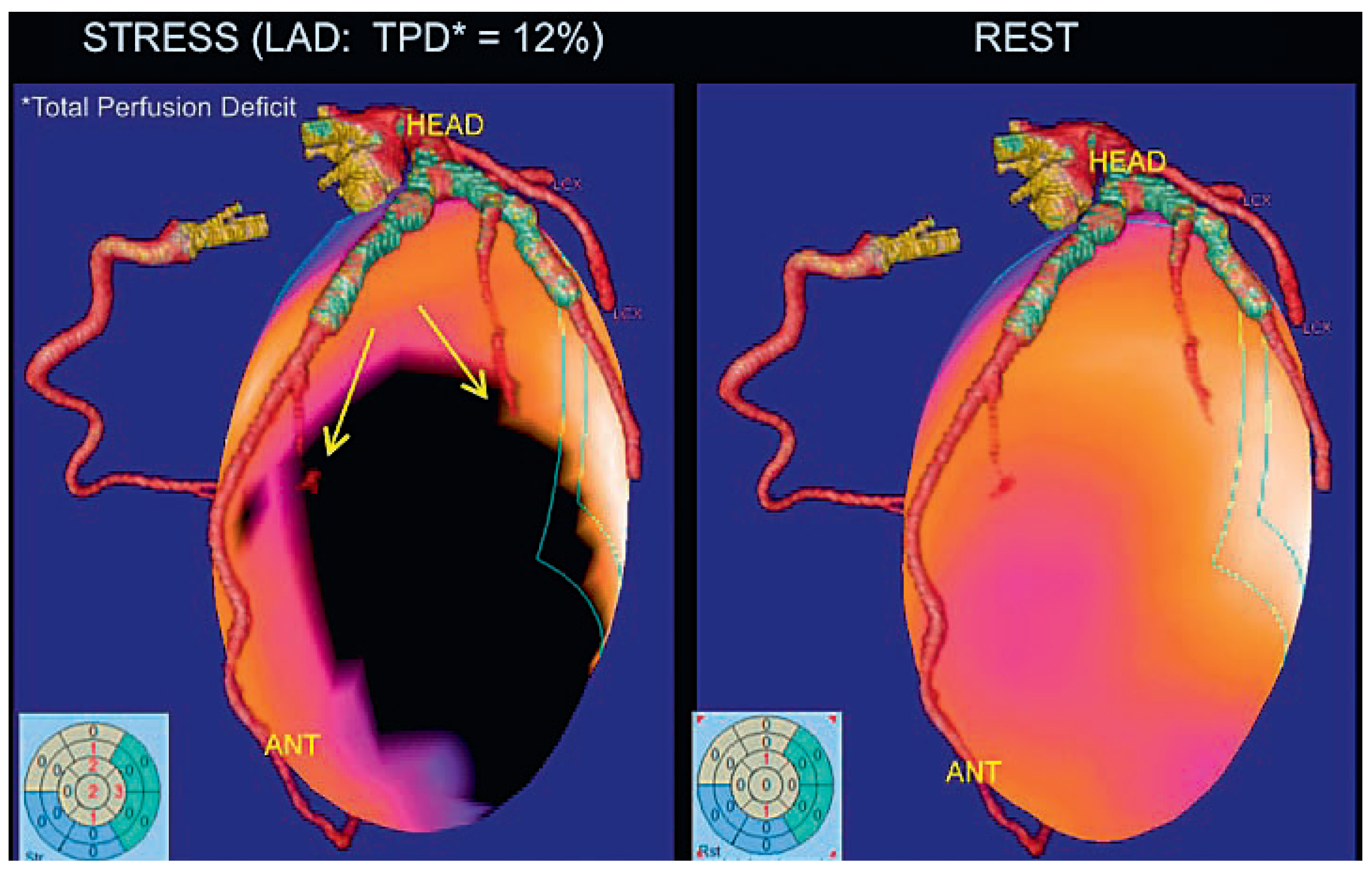 Cardiovascmed 11 00196 g004