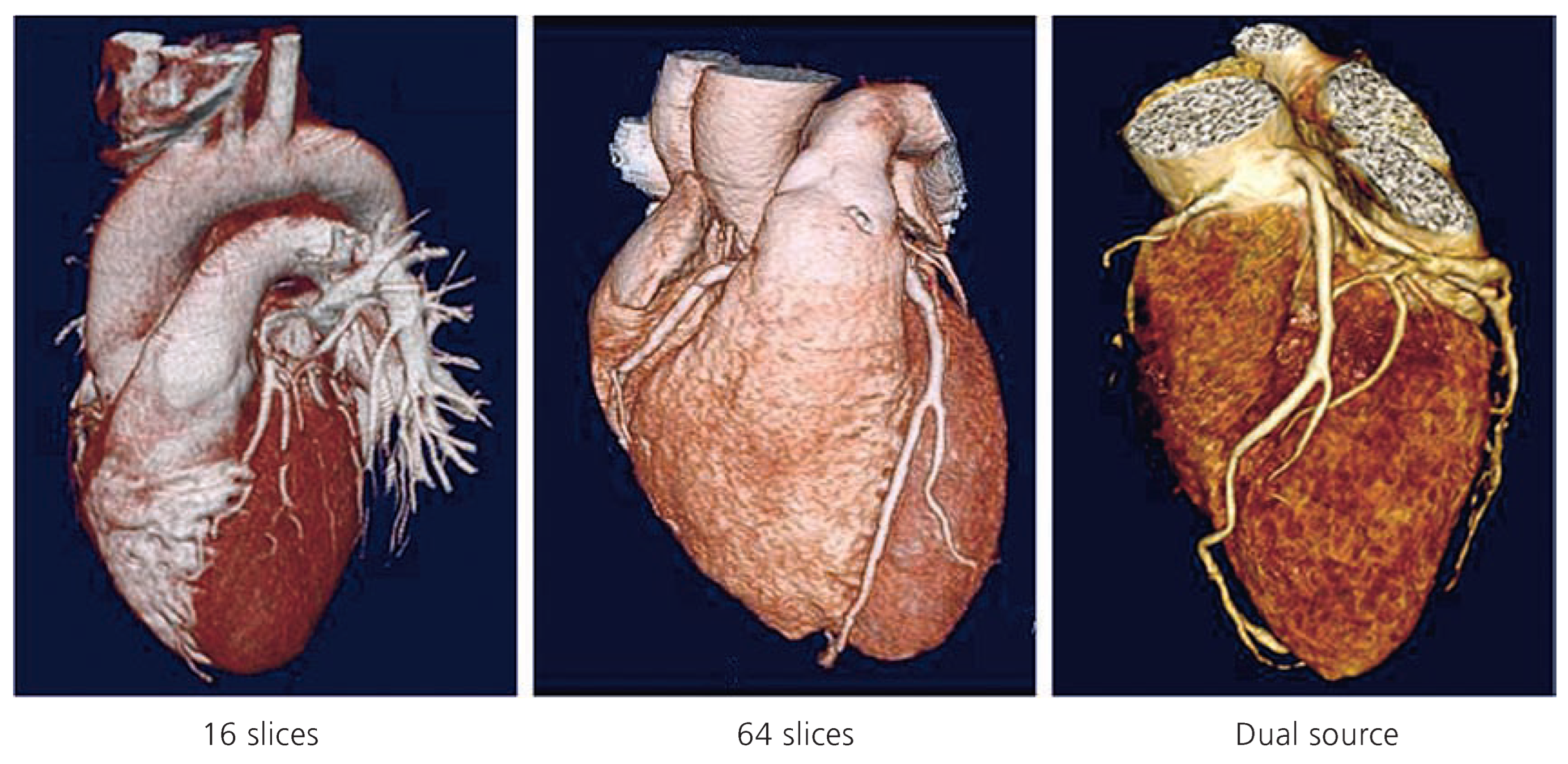 Cardiovascmed 11 00202 g001