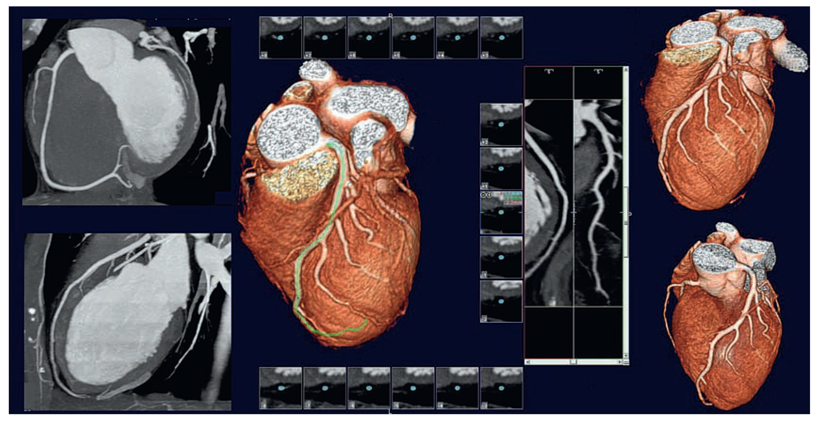 Cardiovascmed 11 00202 g003