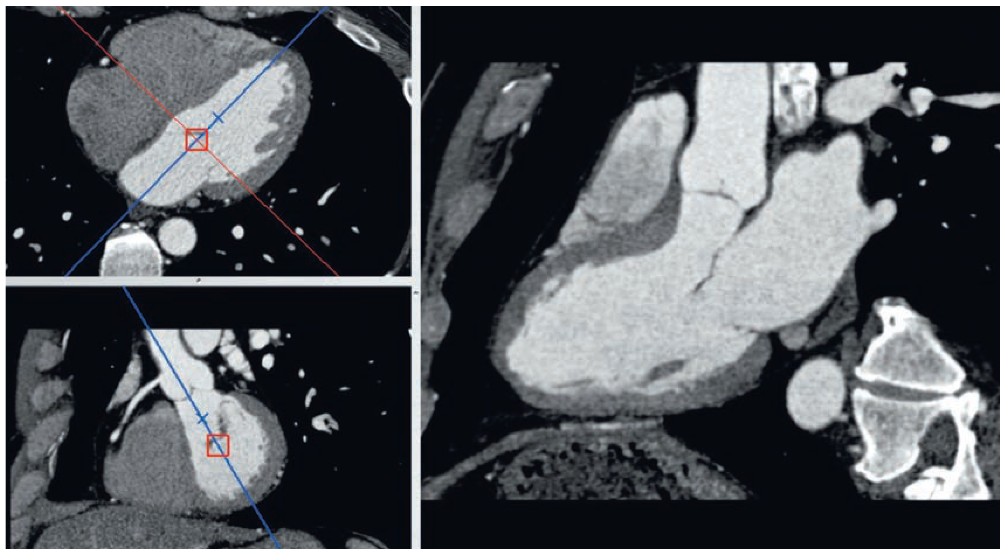 Cardiovascmed 11 00202 g004