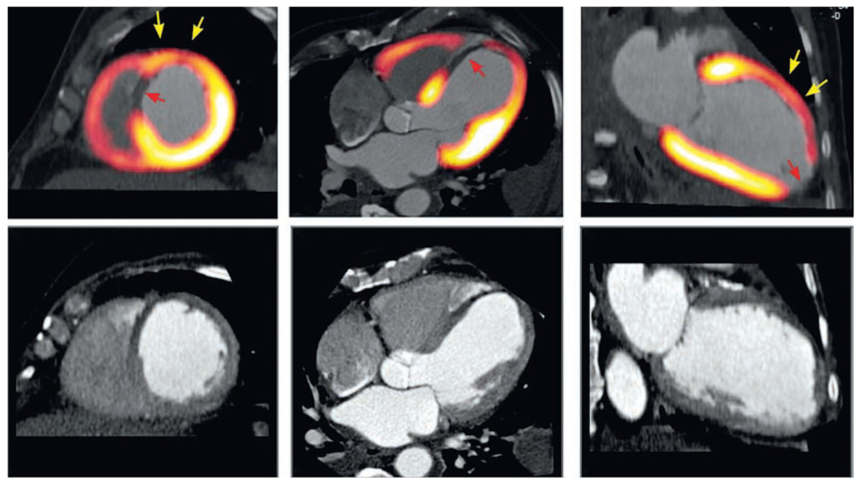 Cardiovascmed 11 00202 g005