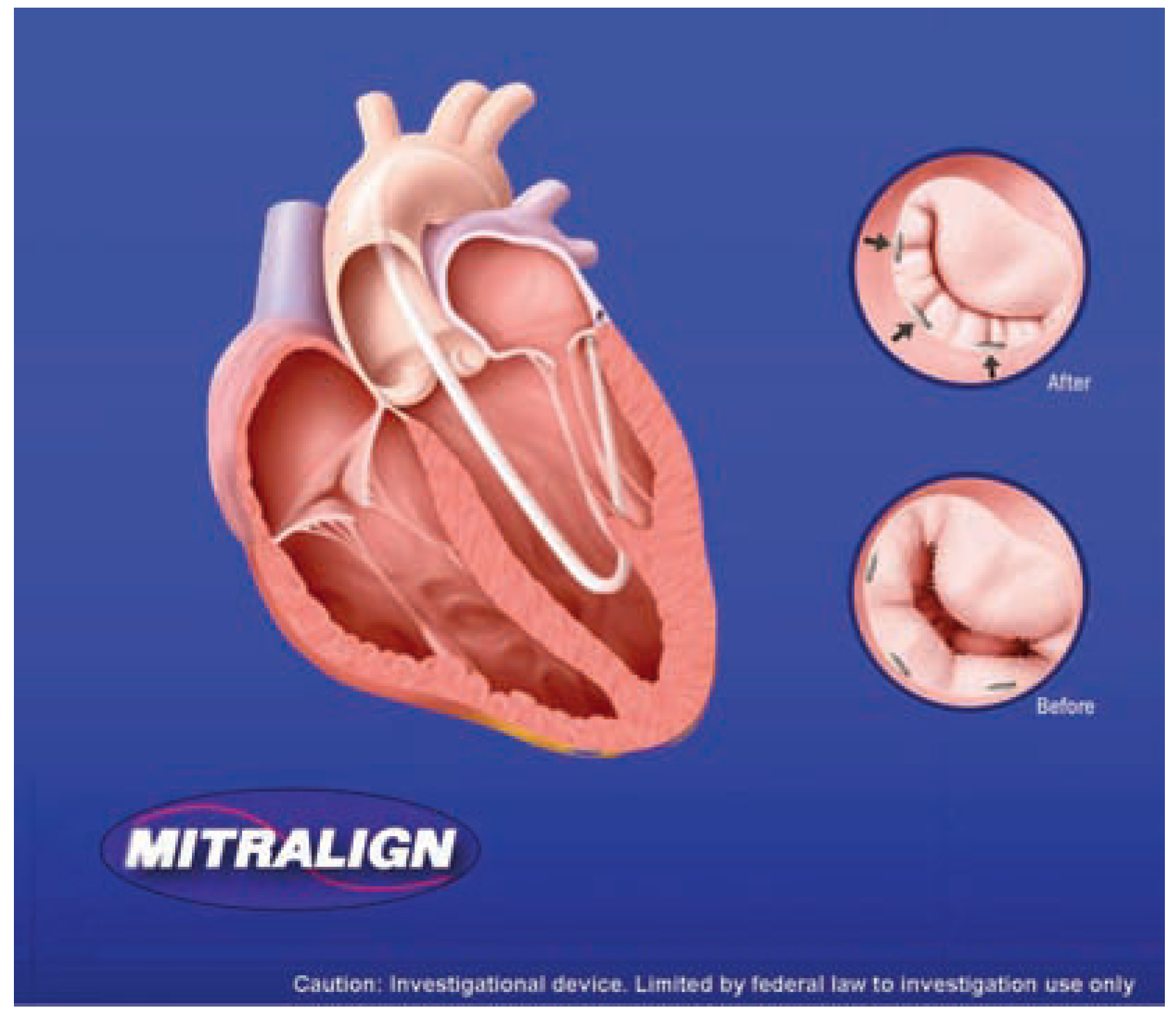 Cardiovascmed 11 00209 g004 Cardiovascmed 11 00209 g004