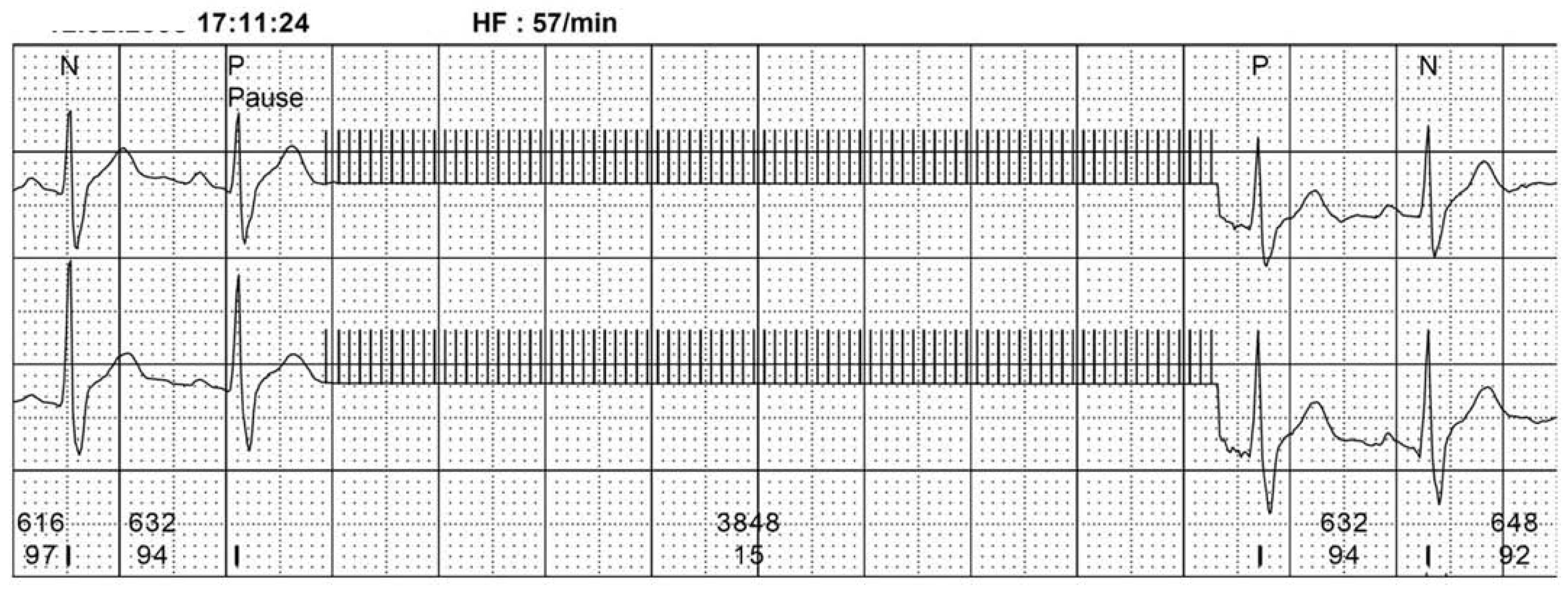 Cardiovascmed 11 00217 g001 Cardiovascmed 11 00217 g001