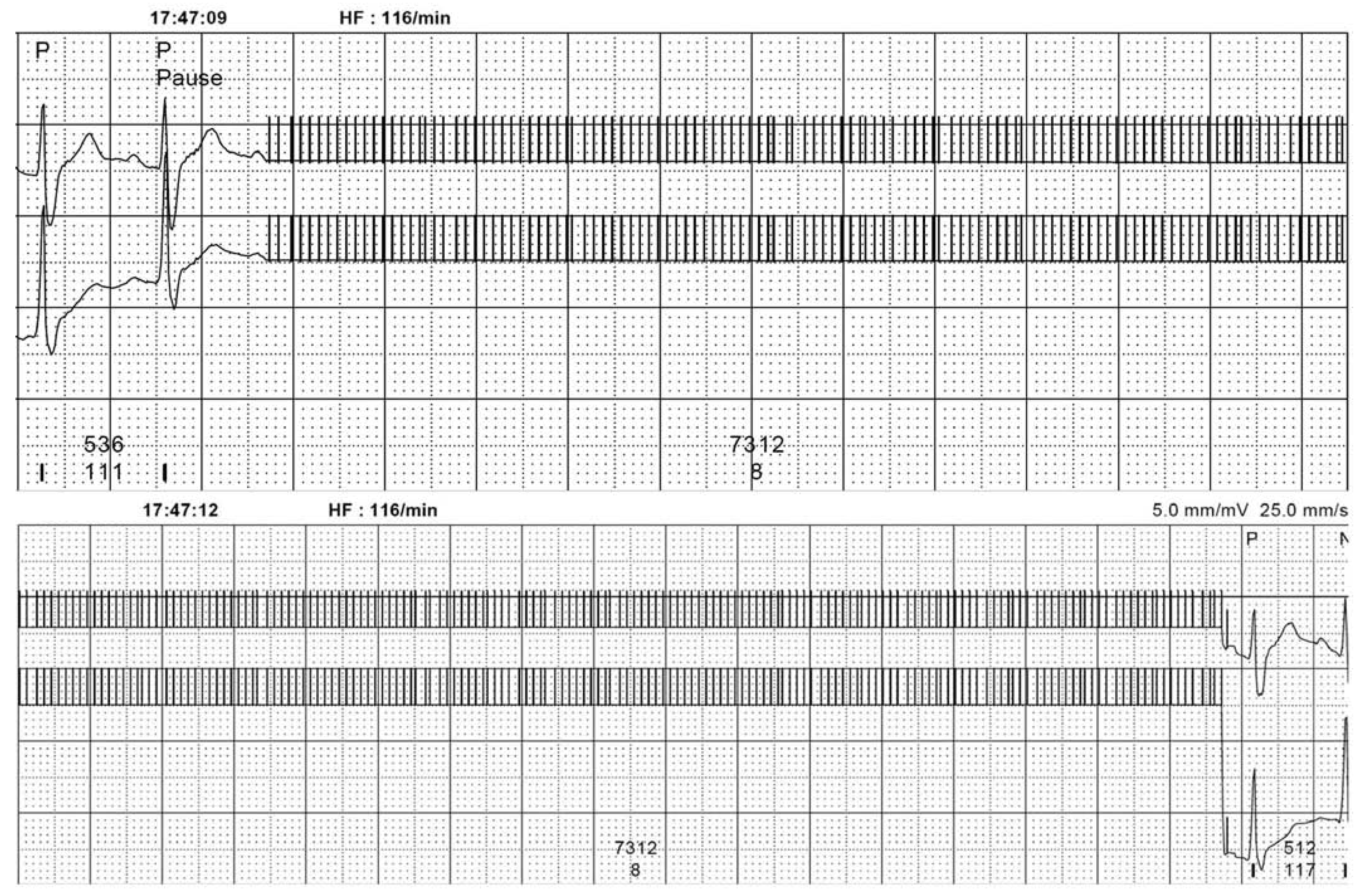Cardiovascmed 11 00217 g002 Cardiovascmed 11 00217 g002