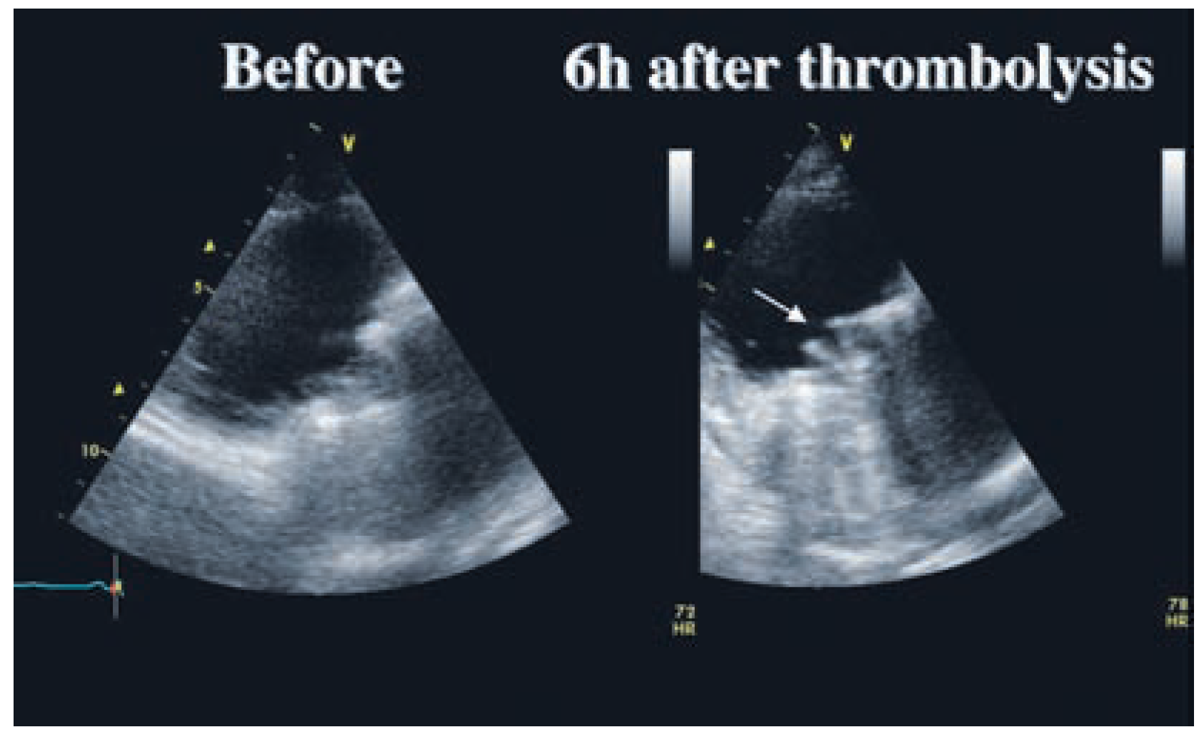Cardiovascmed 11 00219 g001 Cardiovascmed 11 00219 g001