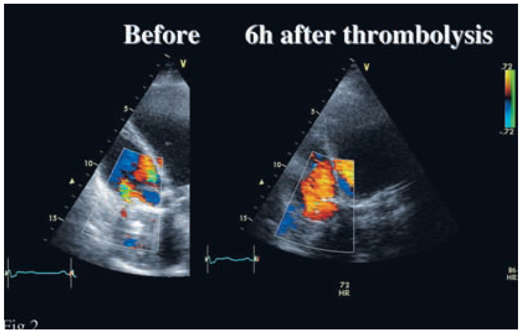 Cardiovascmed 11 00219 g002 Cardiovascmed 11 00219 g002