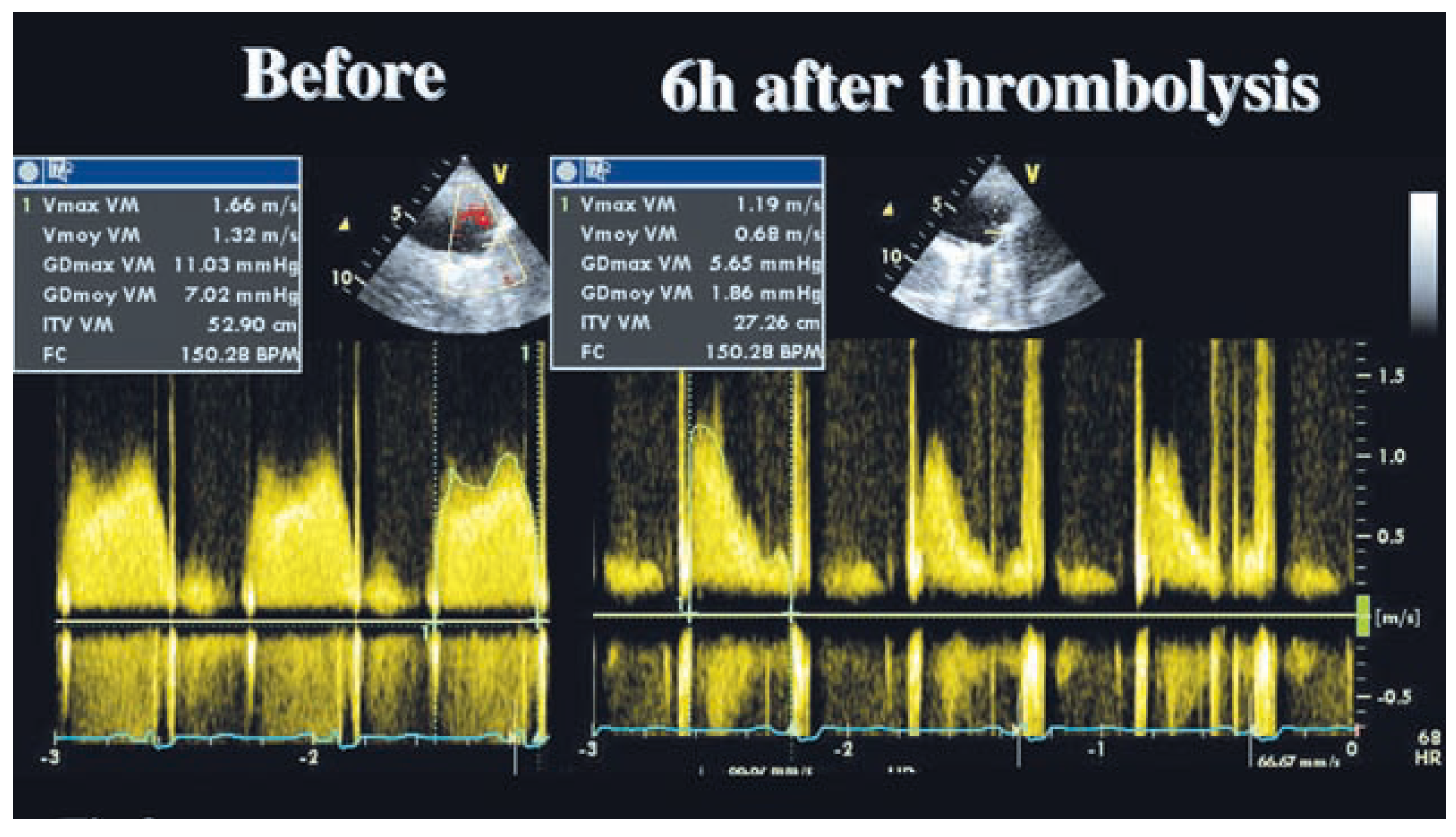 Cardiovascmed 11 00219 g003 Cardiovascmed 11 00219 g003
