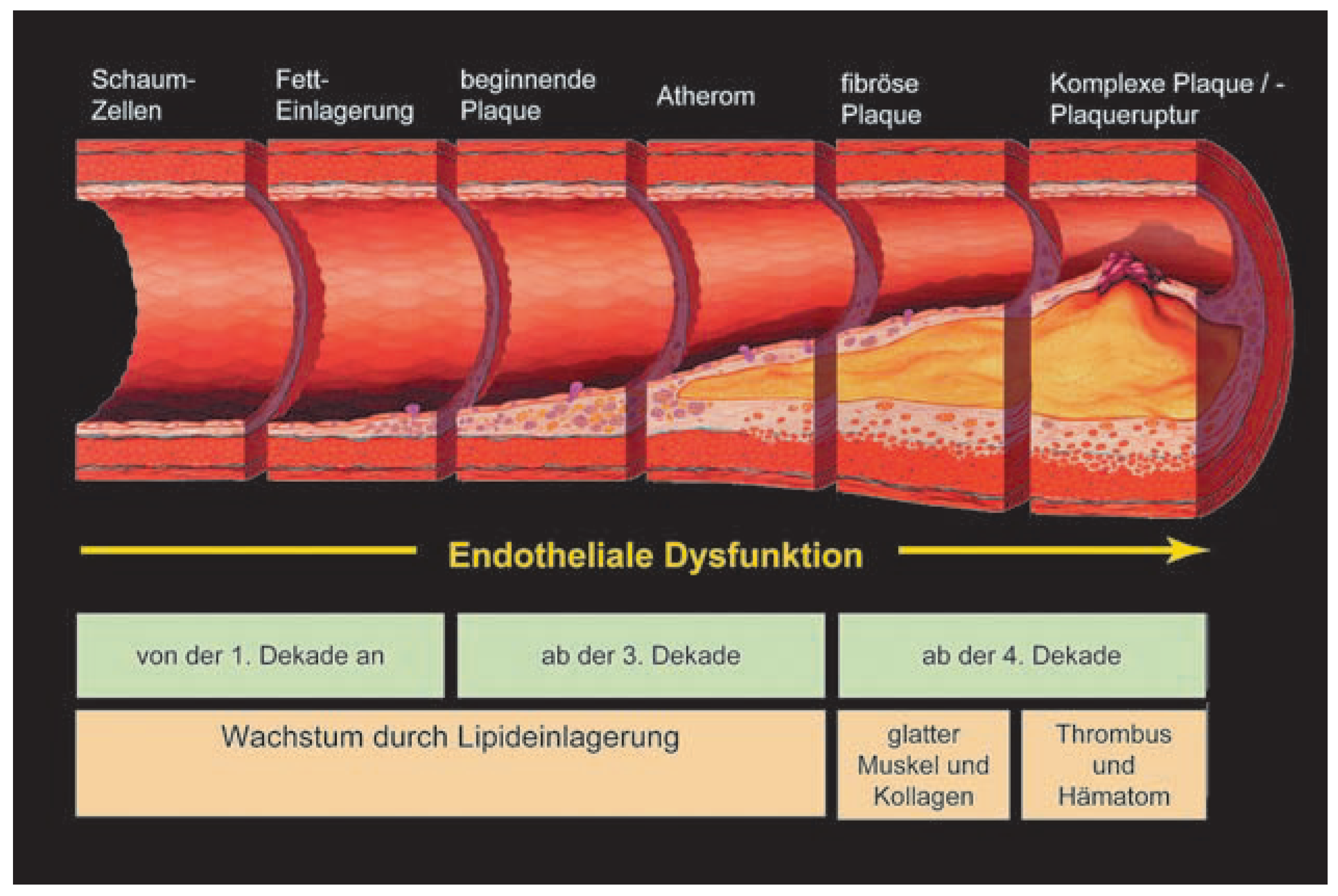 Cardiovascmed 11 00237 g001