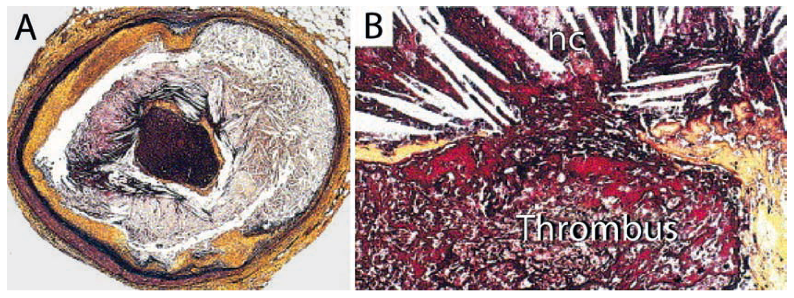 Cardiovascmed 11 00246 g001