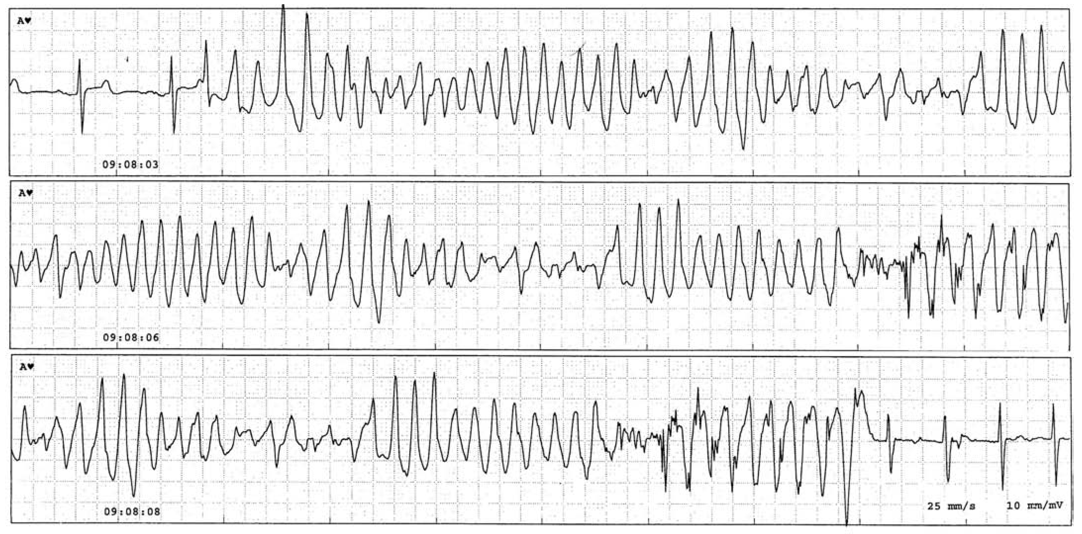 Cardiovascmed 11 00254 g001