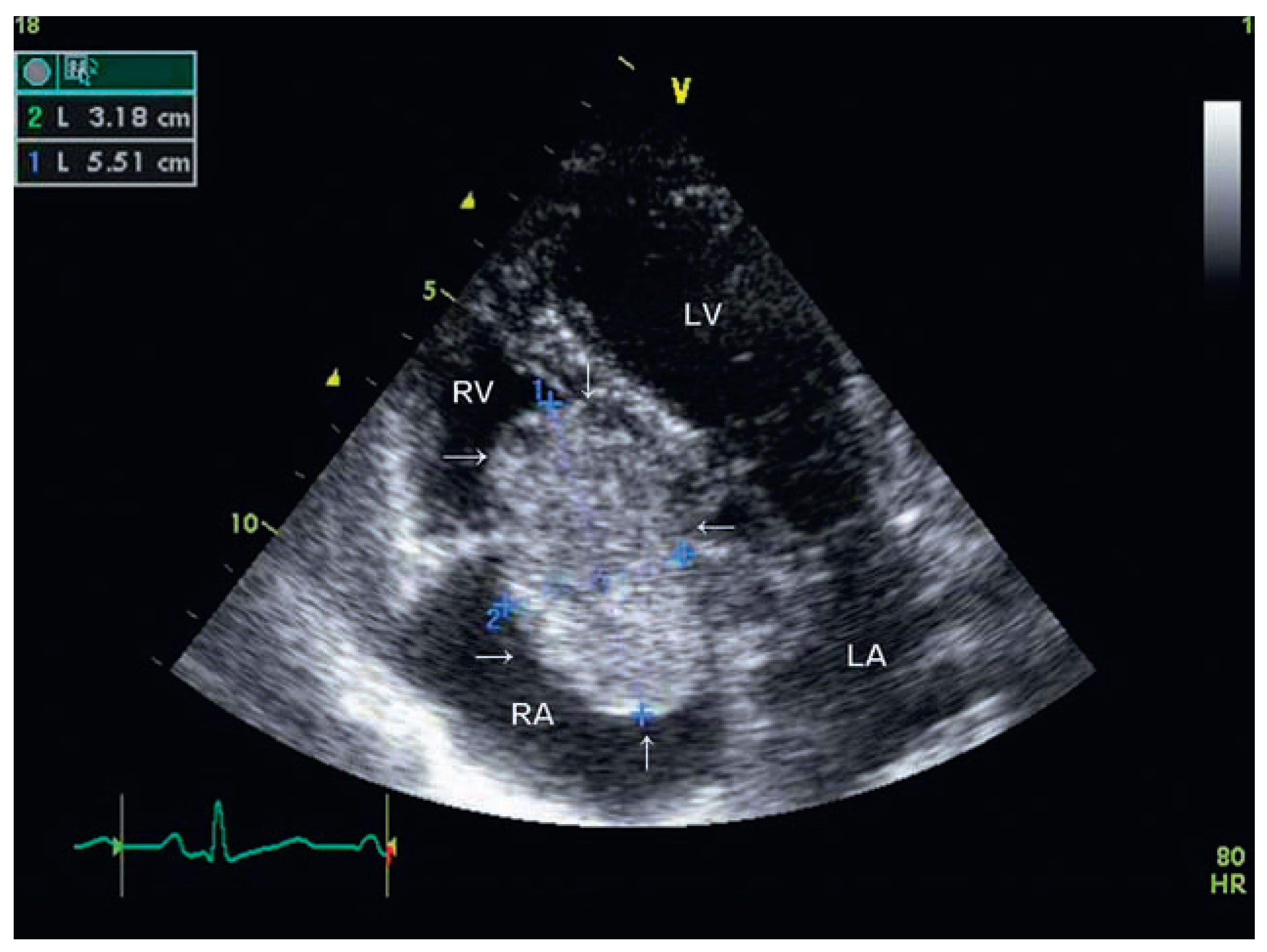 Cardiovascmed 11 00256 g001 Cardiovascmed 11 00256 g001