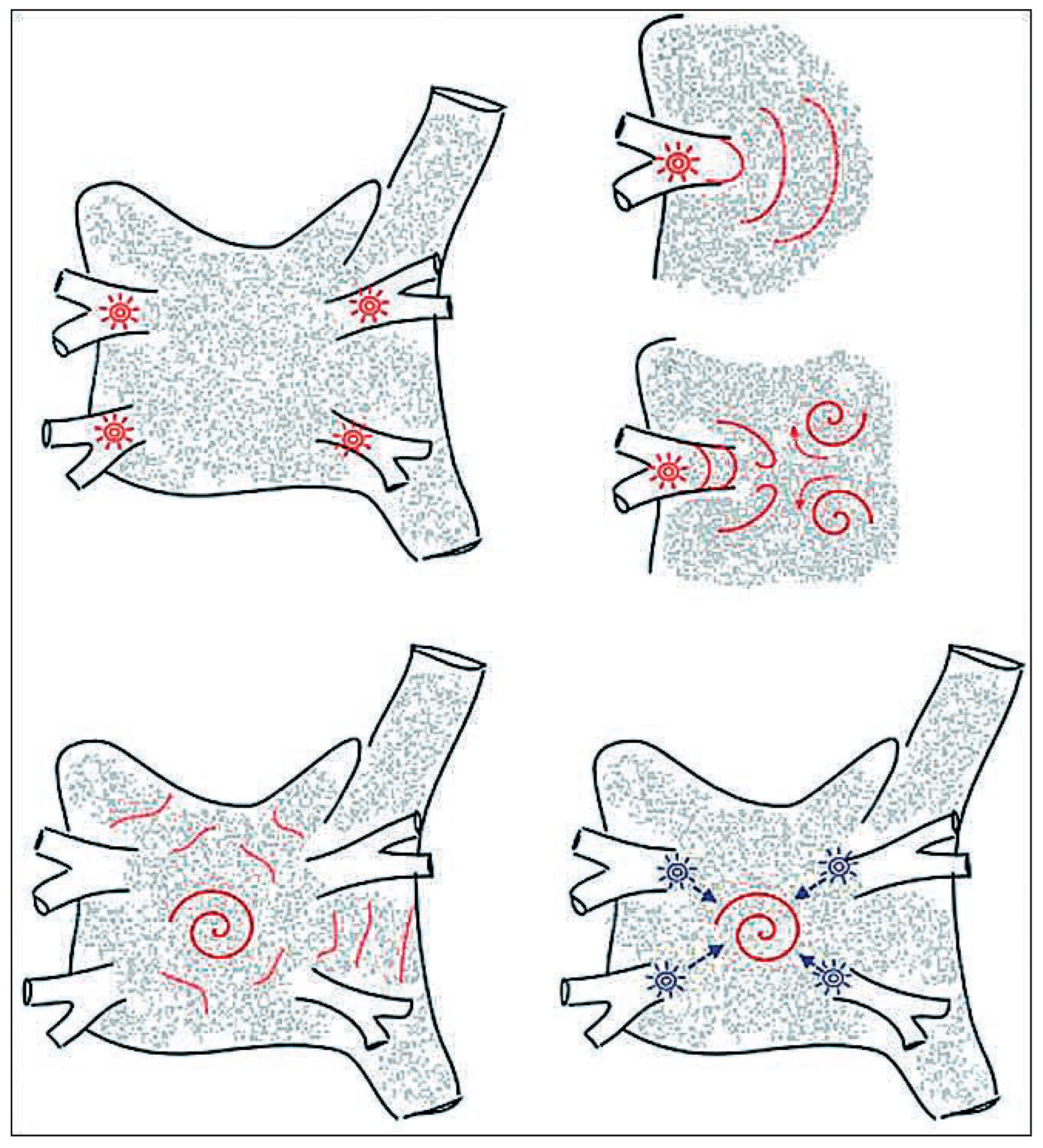 Cardiovascmed 11 00265 g003 Cardiovascmed 11 00265 g003