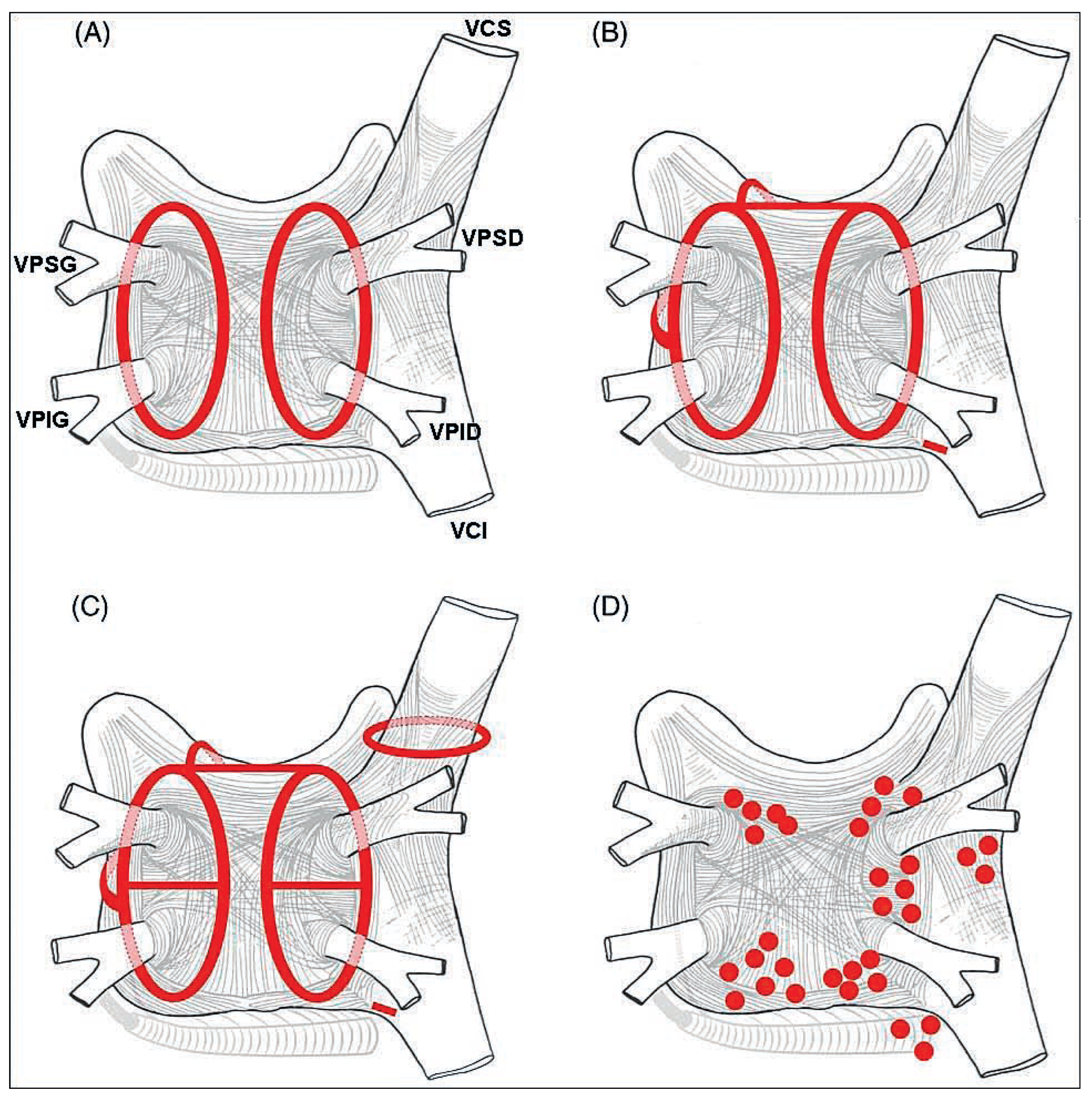 Cardiovascmed 11 00265 g004 Cardiovascmed 11 00265 g004