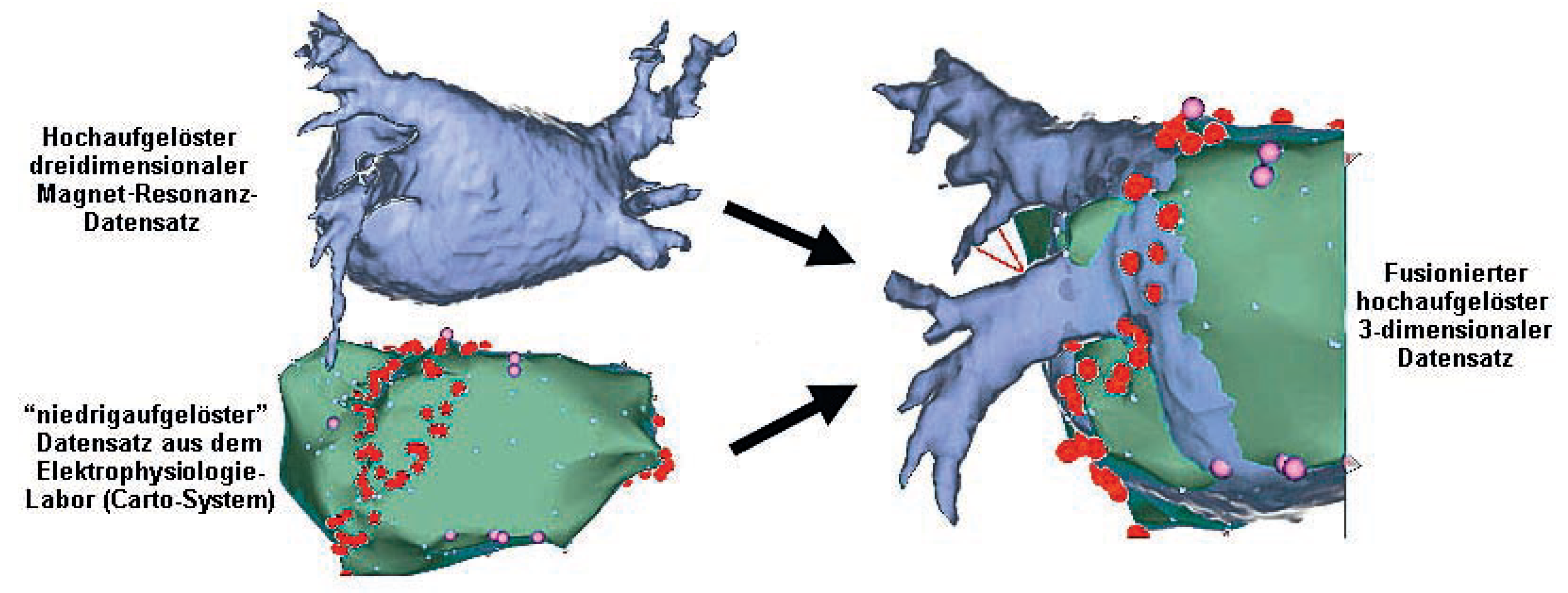 Cardiovascmed 11 00303 g004