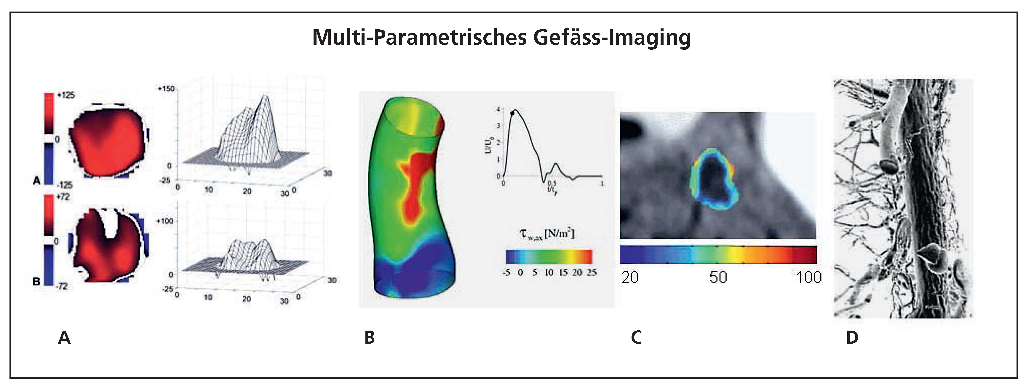 Cardiovascmed 11 00303 g005
