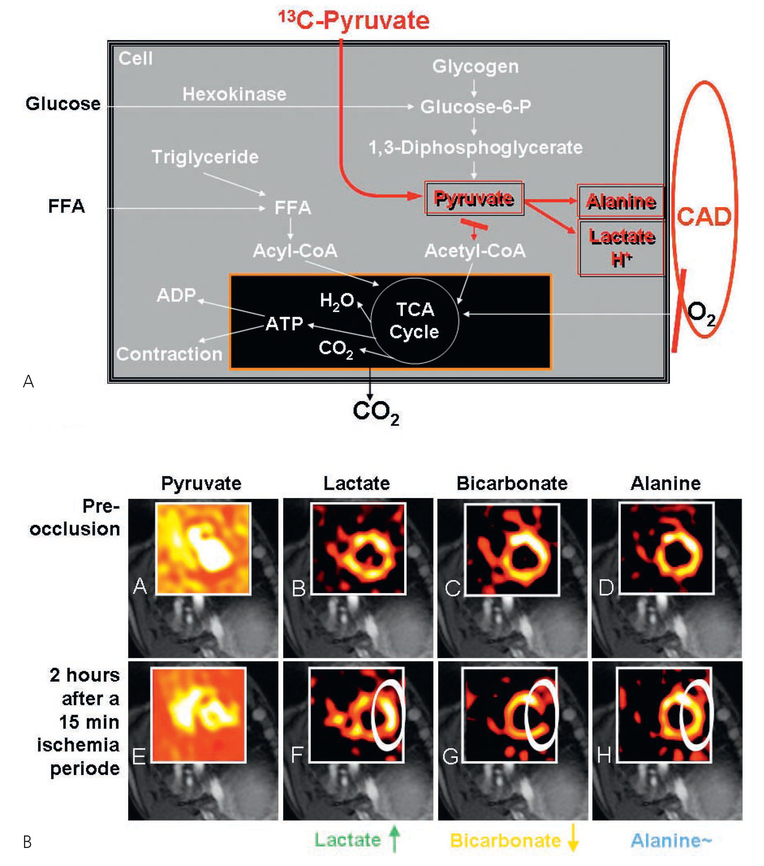 Cardiovascmed 11 00303 g006