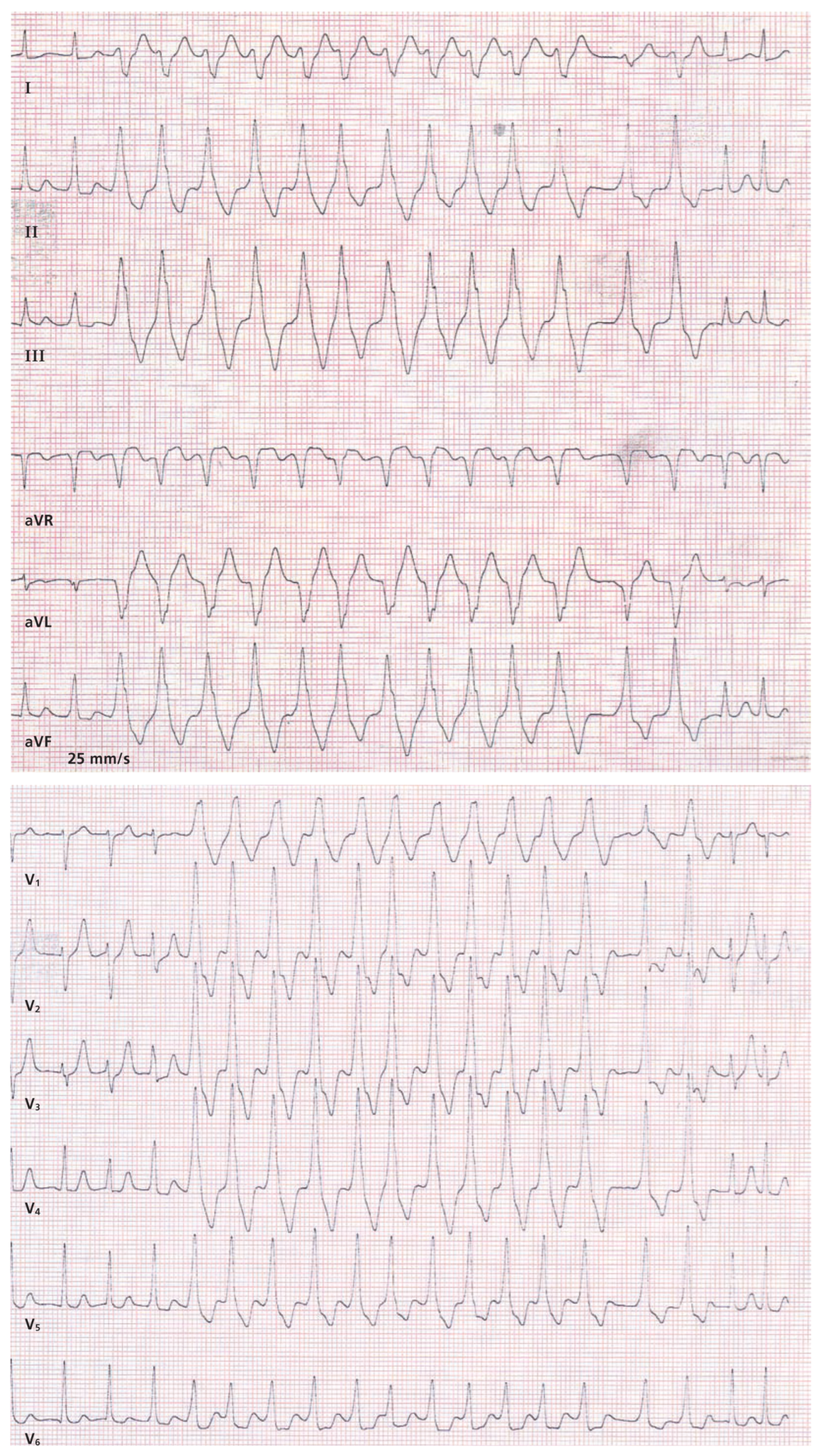 Cardiovascmed 11 00321 g001 Cardiovascmed 11 00321 g001