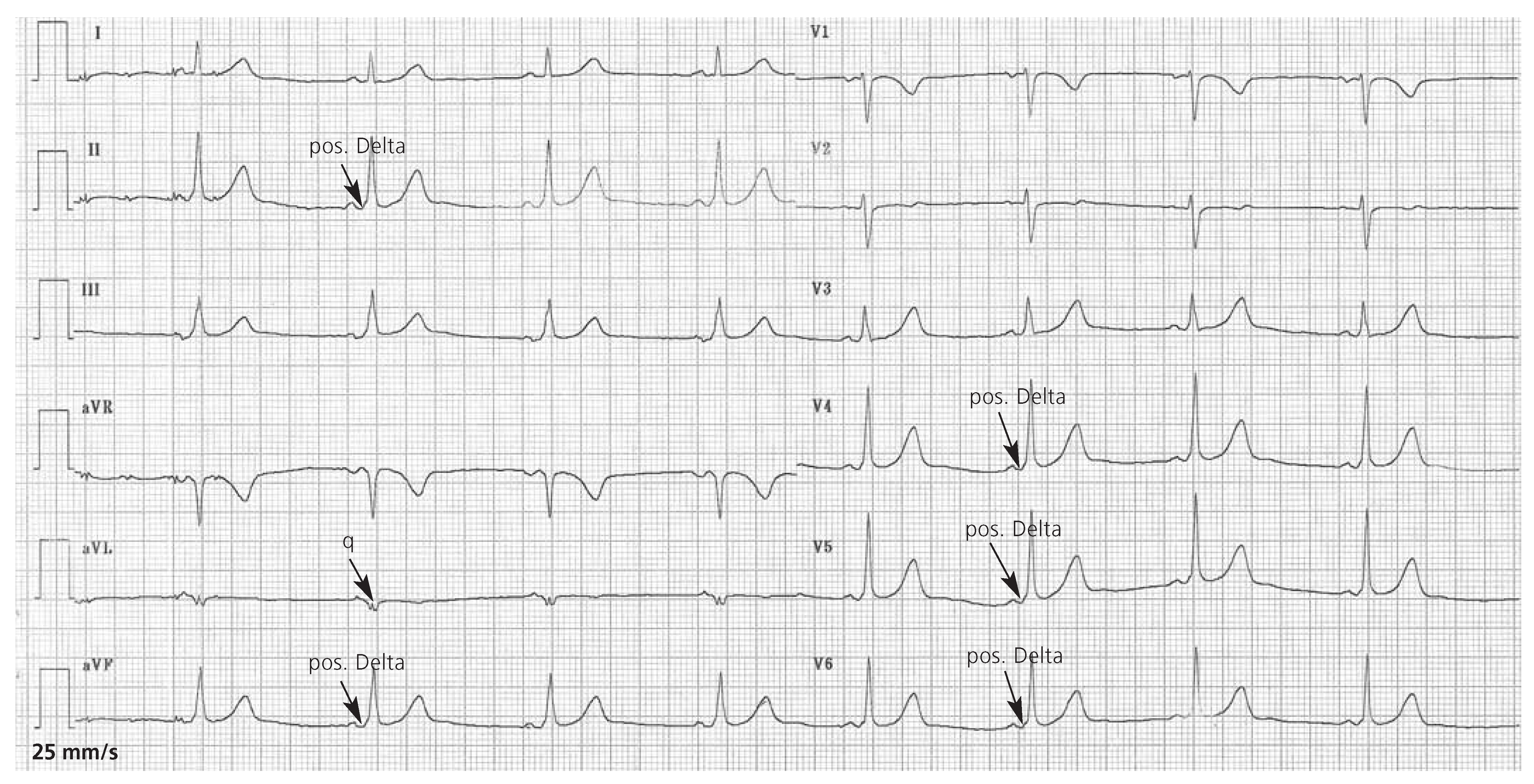 Cardiovascmed 11 00321 g002 Cardiovascmed 11 00321 g002