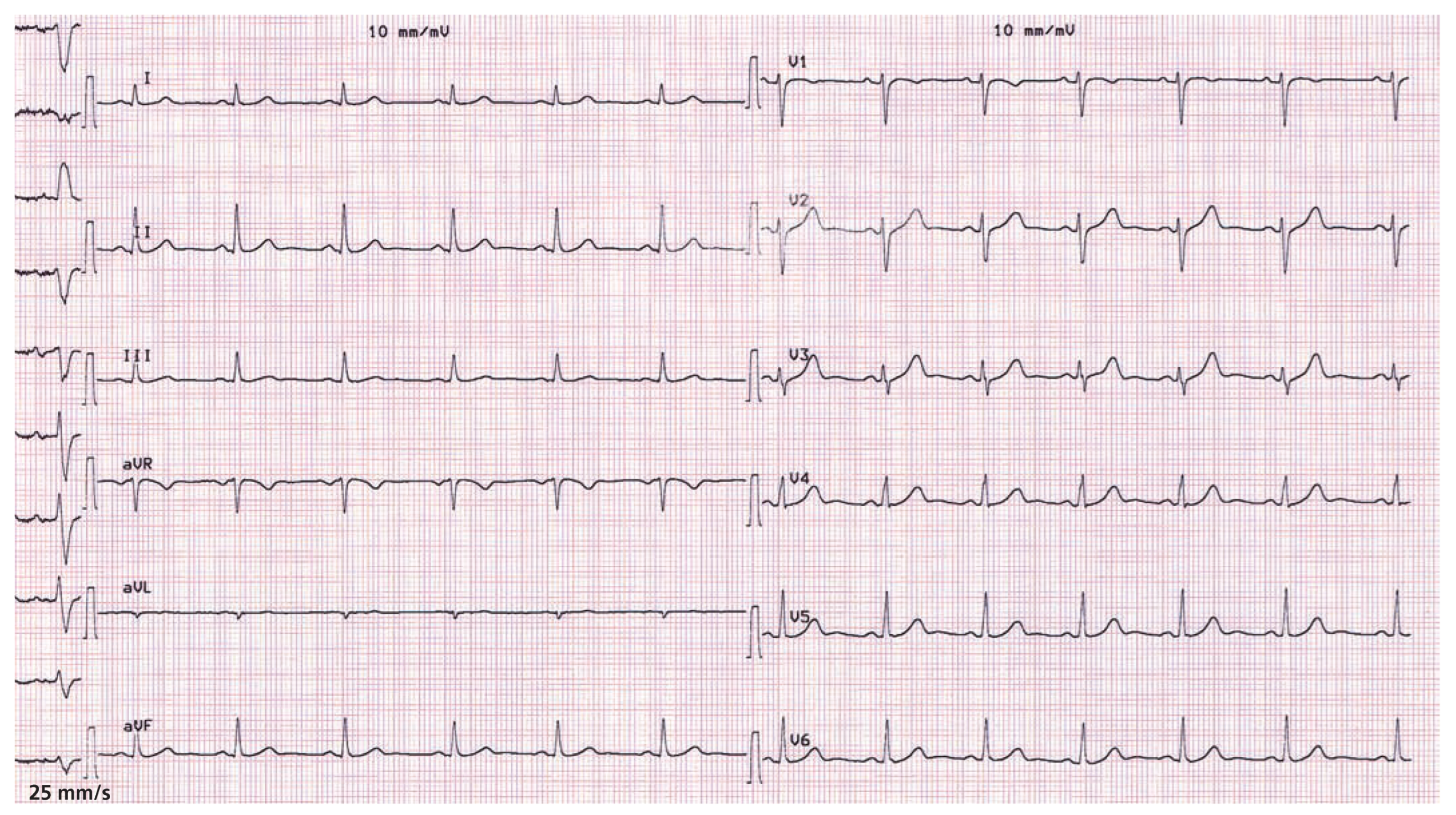 Cardiovascmed 11 00321 g003 Cardiovascmed 11 00321 g003