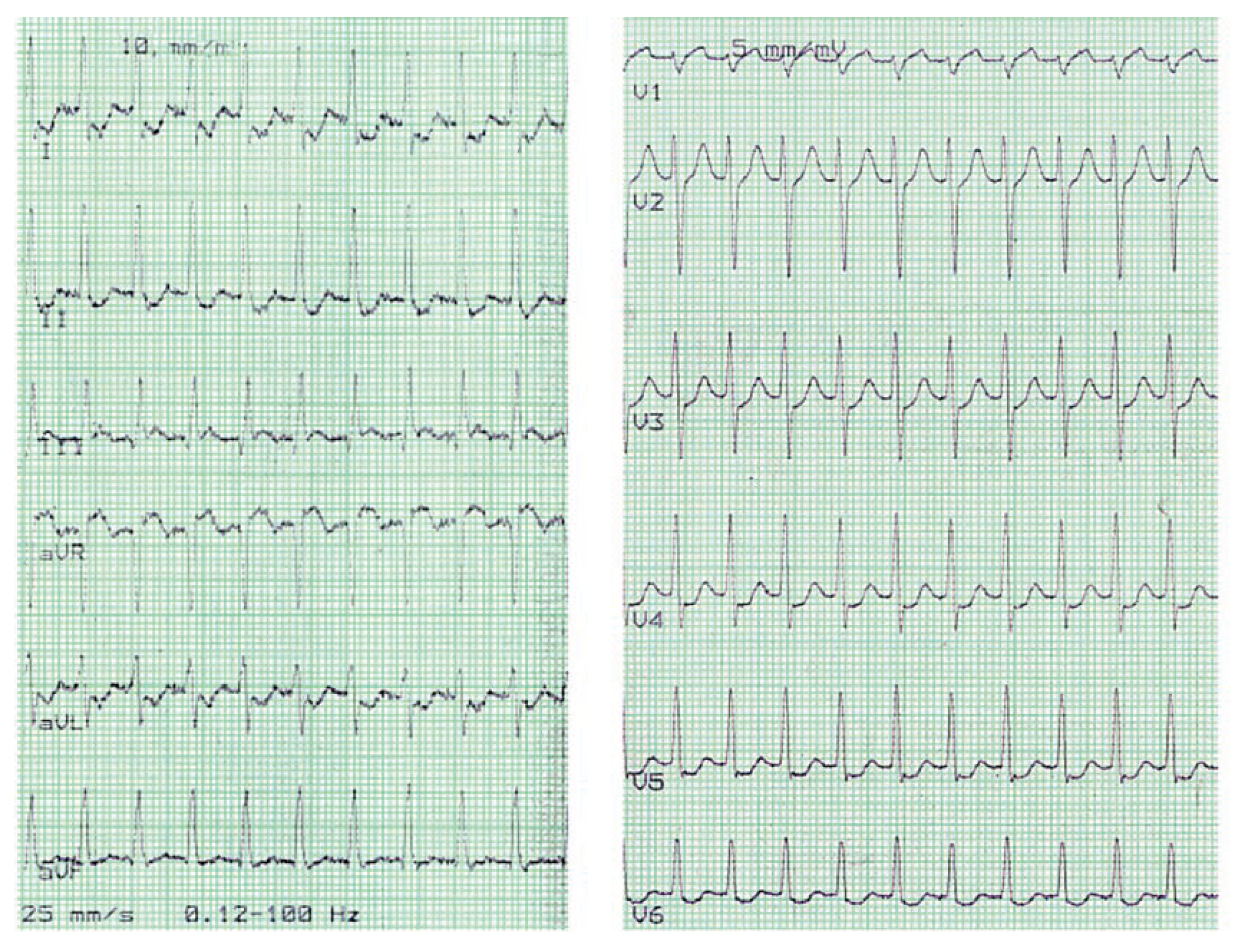 Cardiovascmed 11 00321 g004 Cardiovascmed 11 00321 g004
