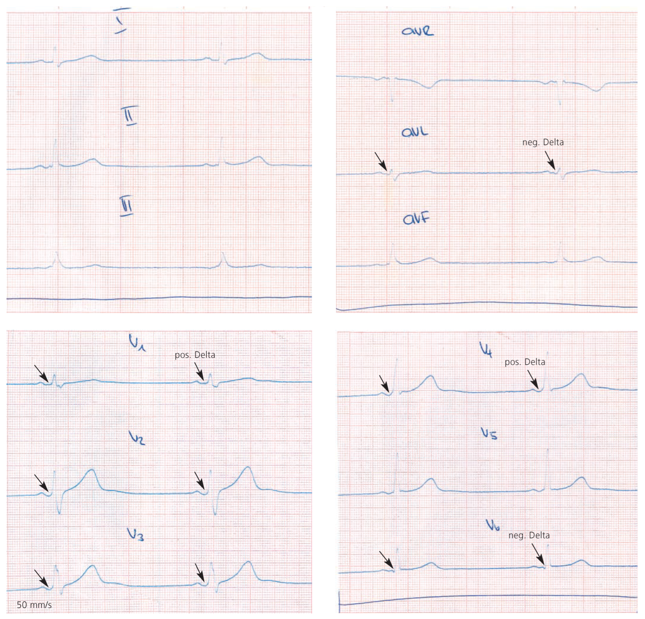 Cardiovascmed 11 00321 g005 Cardiovascmed 11 00321 g005